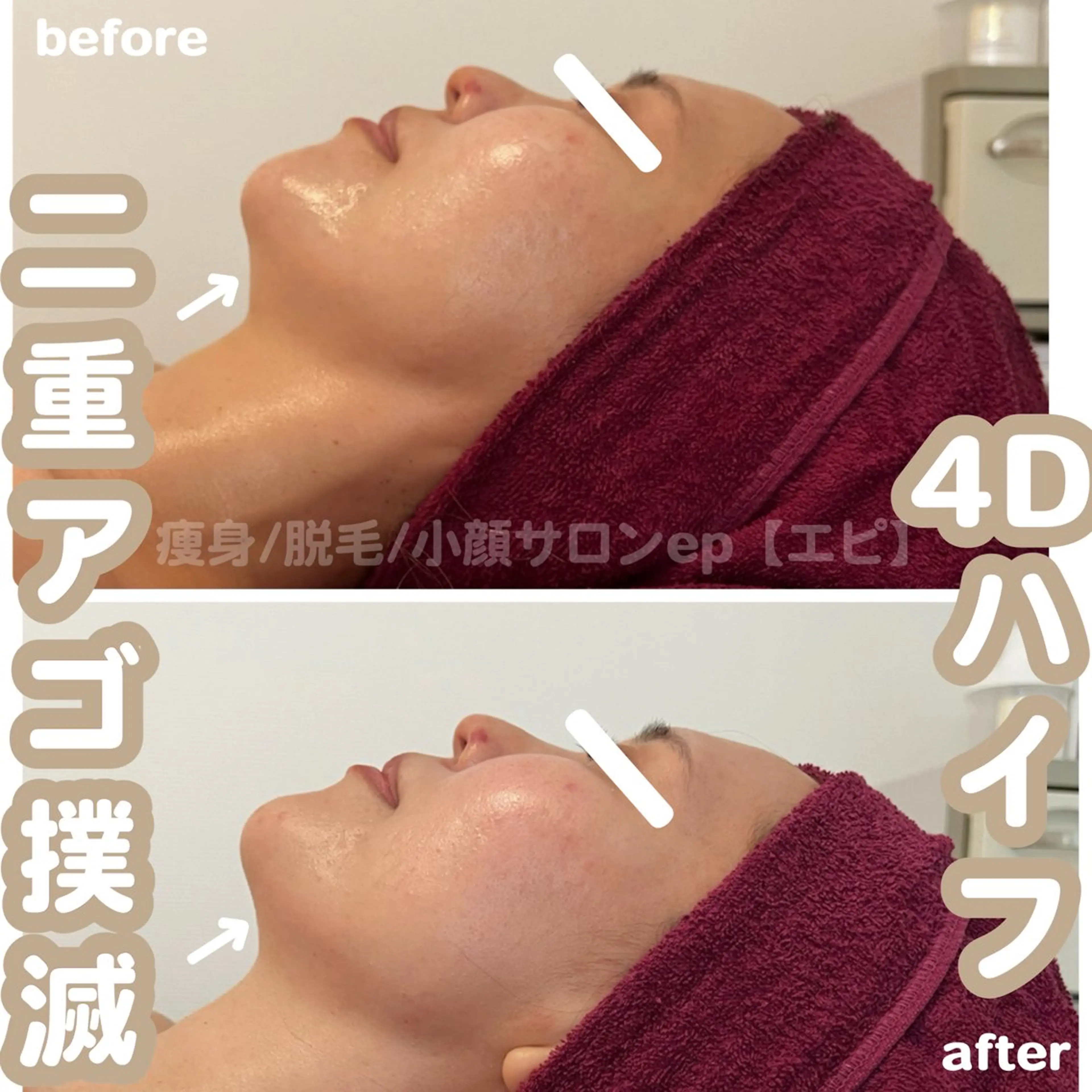 エステ beauty salon epのエステ・リラクイメージ