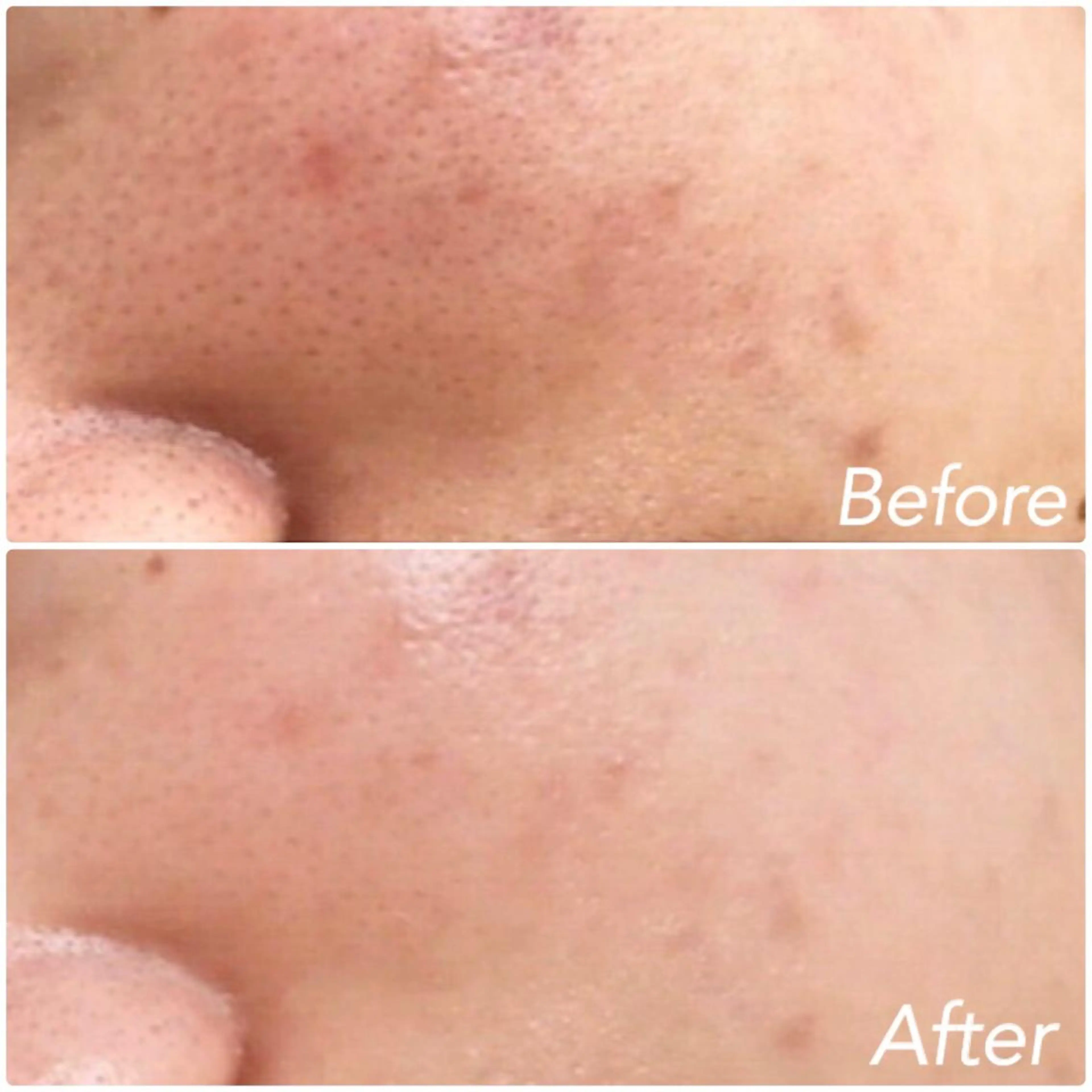 L’Beige レベージュのエステ・リラクイメージ