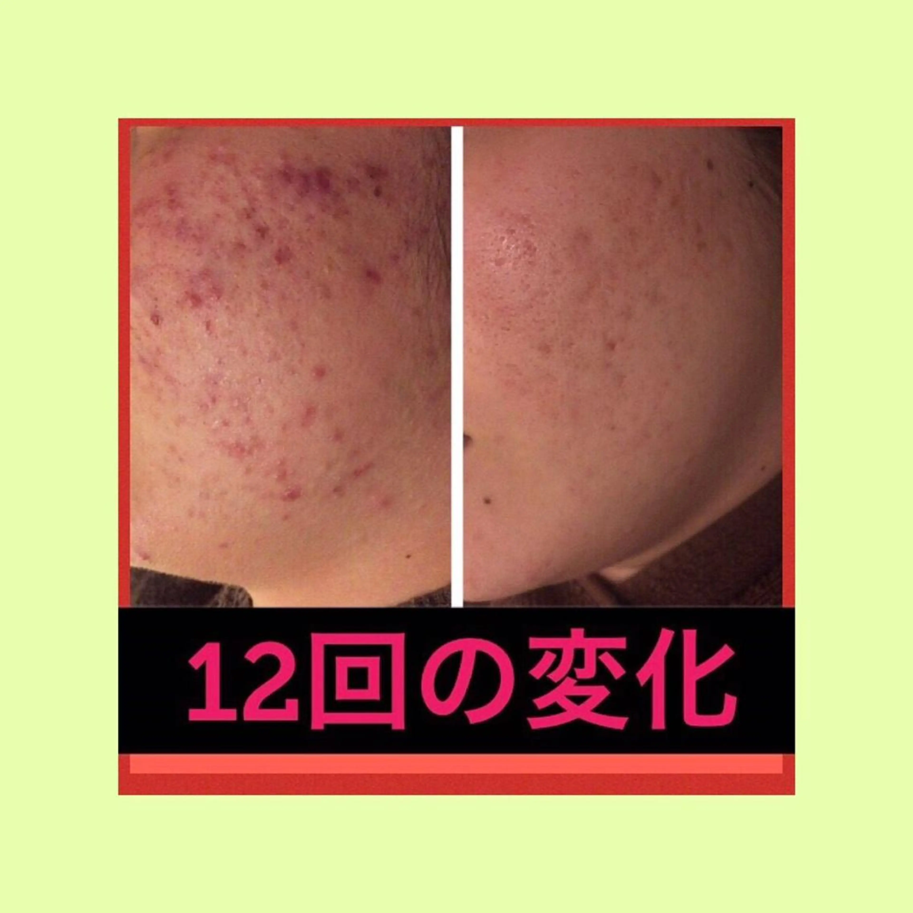 ミディアム カラー パーマ ヘアアレンジ メンズ キッズ ネイル マツエク・マツパ ニキビ・肌質改善専門 ♡人生が変わるサロンのエステ・リラクイメージ