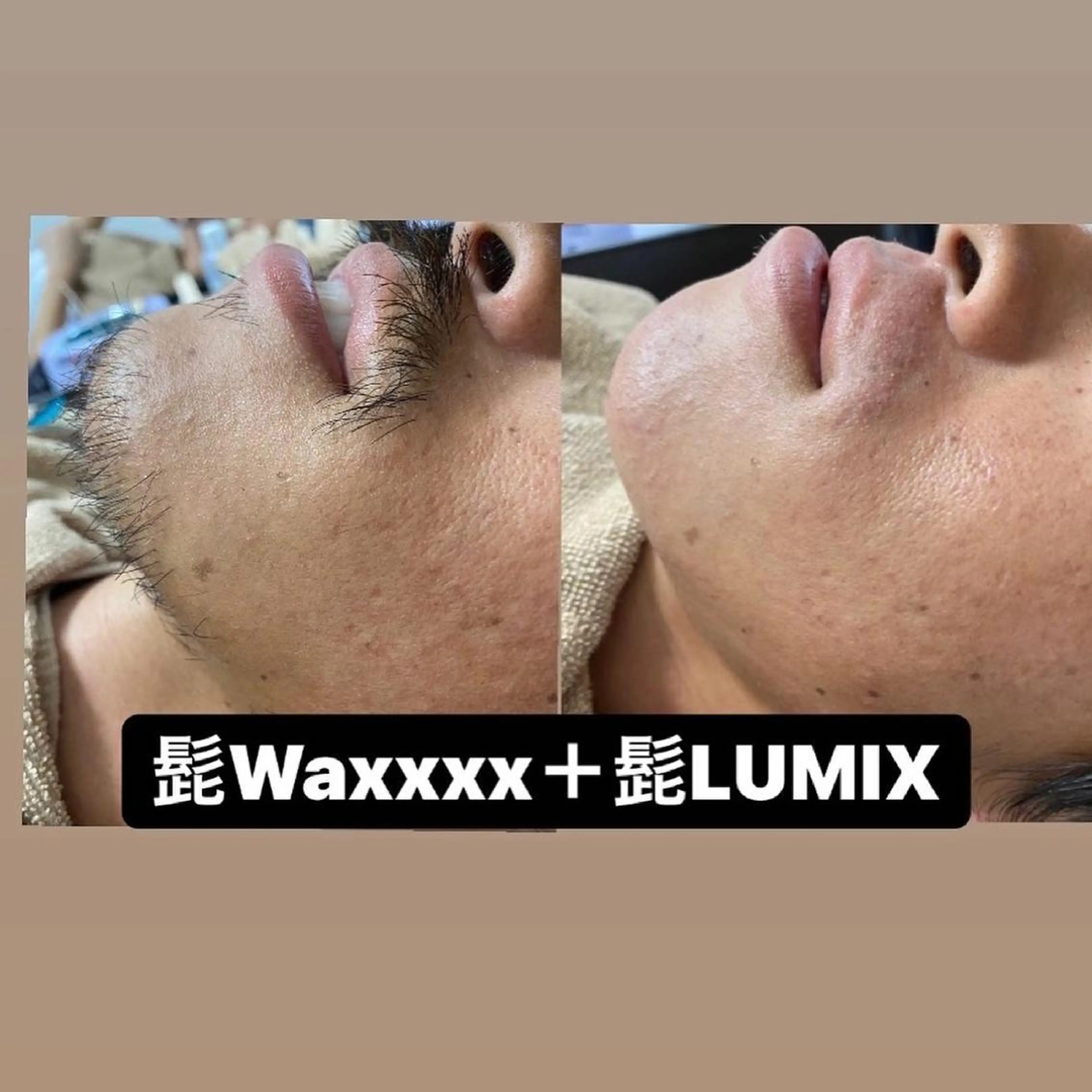 脱毛 Epina 千葉店 【エピナ】のエステ・リラクイメージ