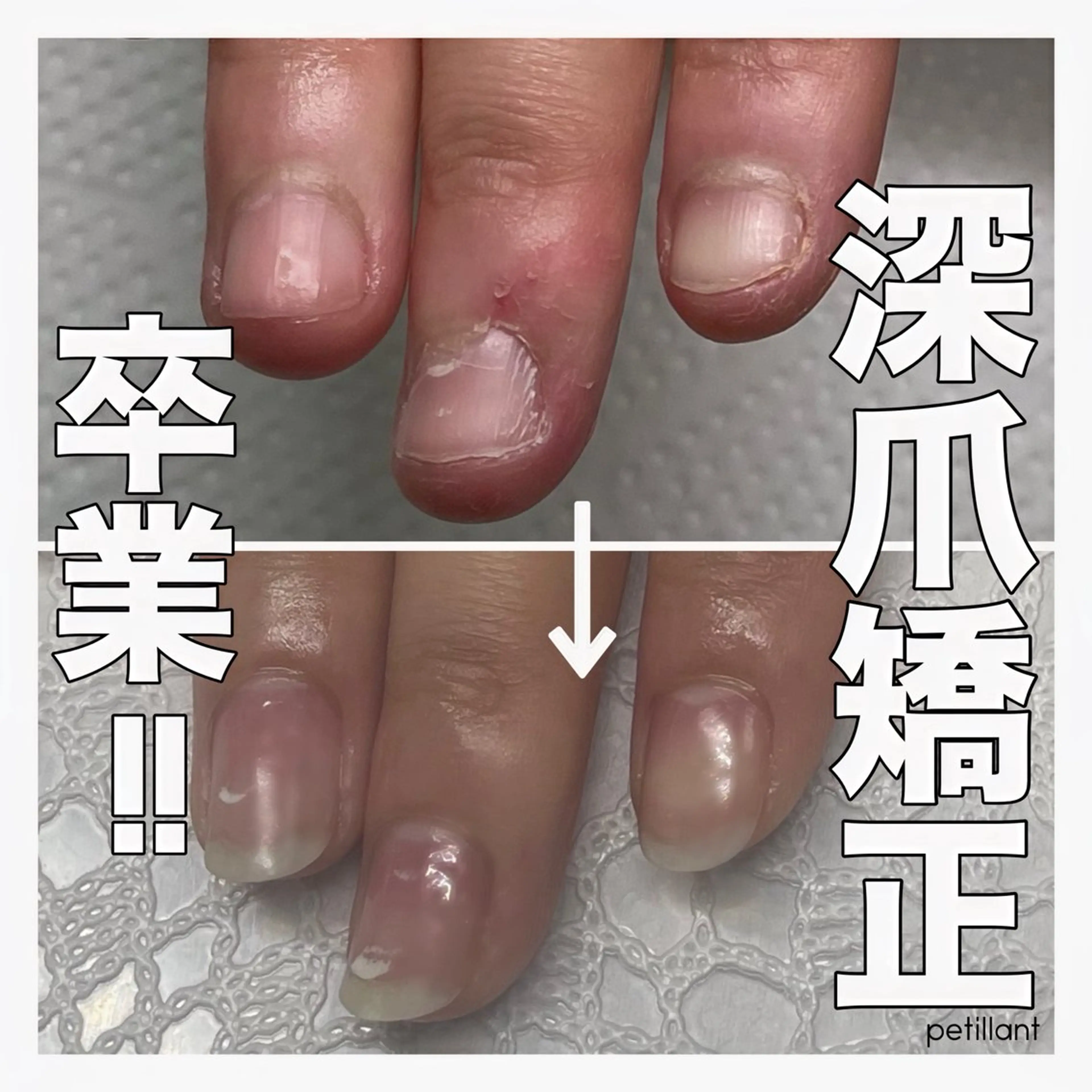 ネイル 入学式 卒業式 ピンク ハンドネイル ハンドケア petillant所属・nail salon petillantのネイルデザイン