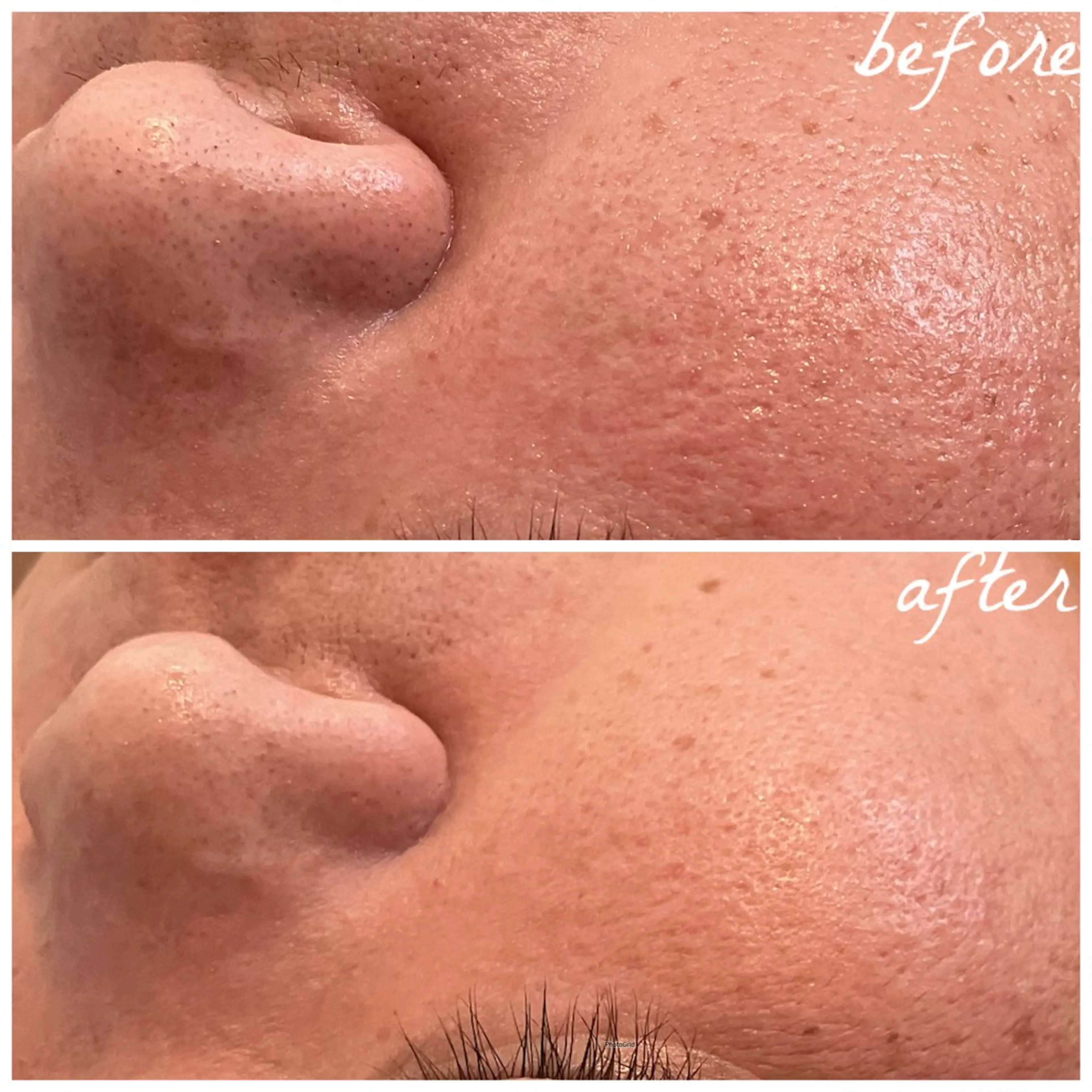 メンズ メナード岐阜茜部 杉浦のエステ・リラクイメージ