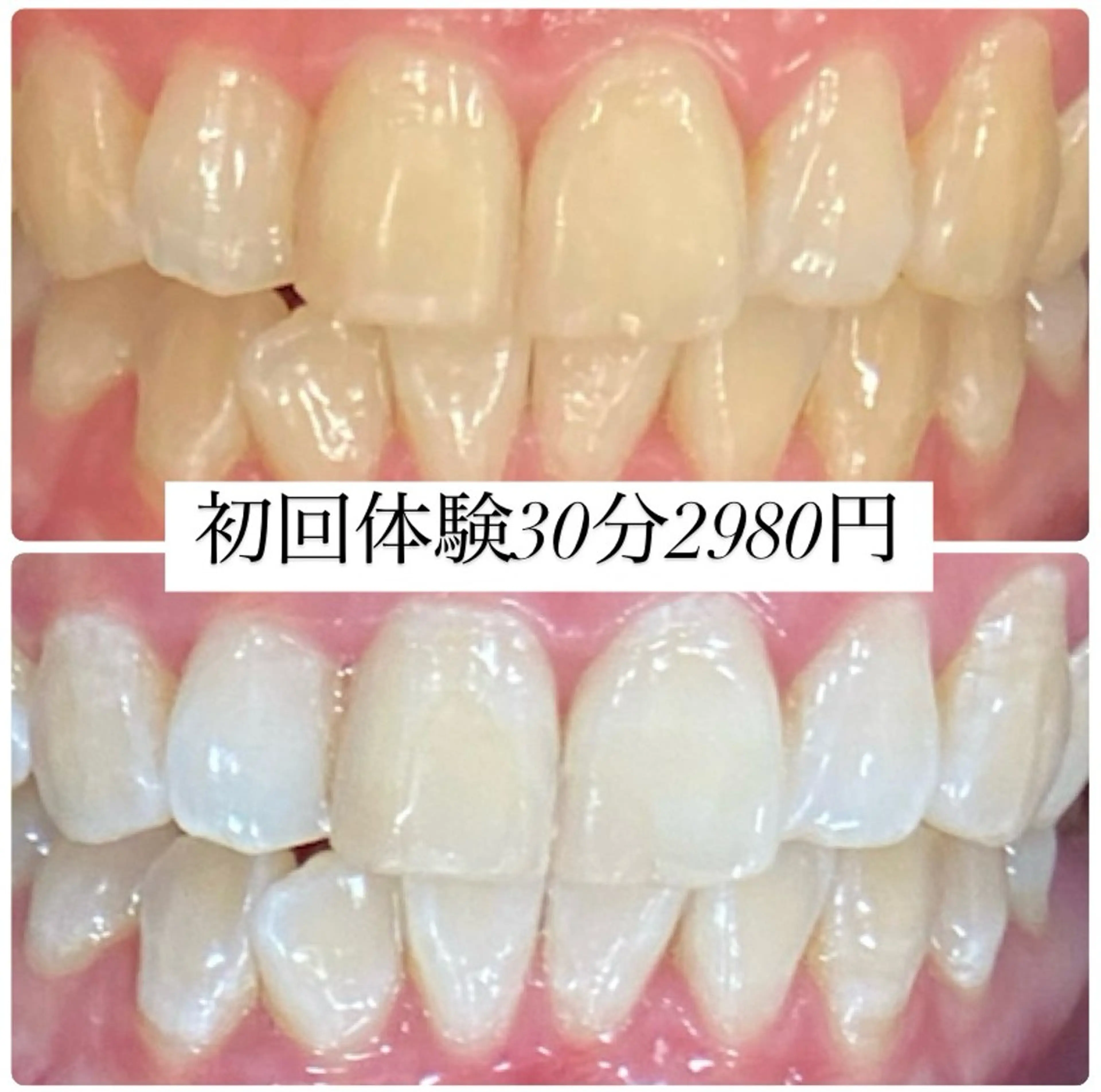 PLATINUM Beauty 横浜店所属・ホワイトニングルーム 横浜店のその他イメージ