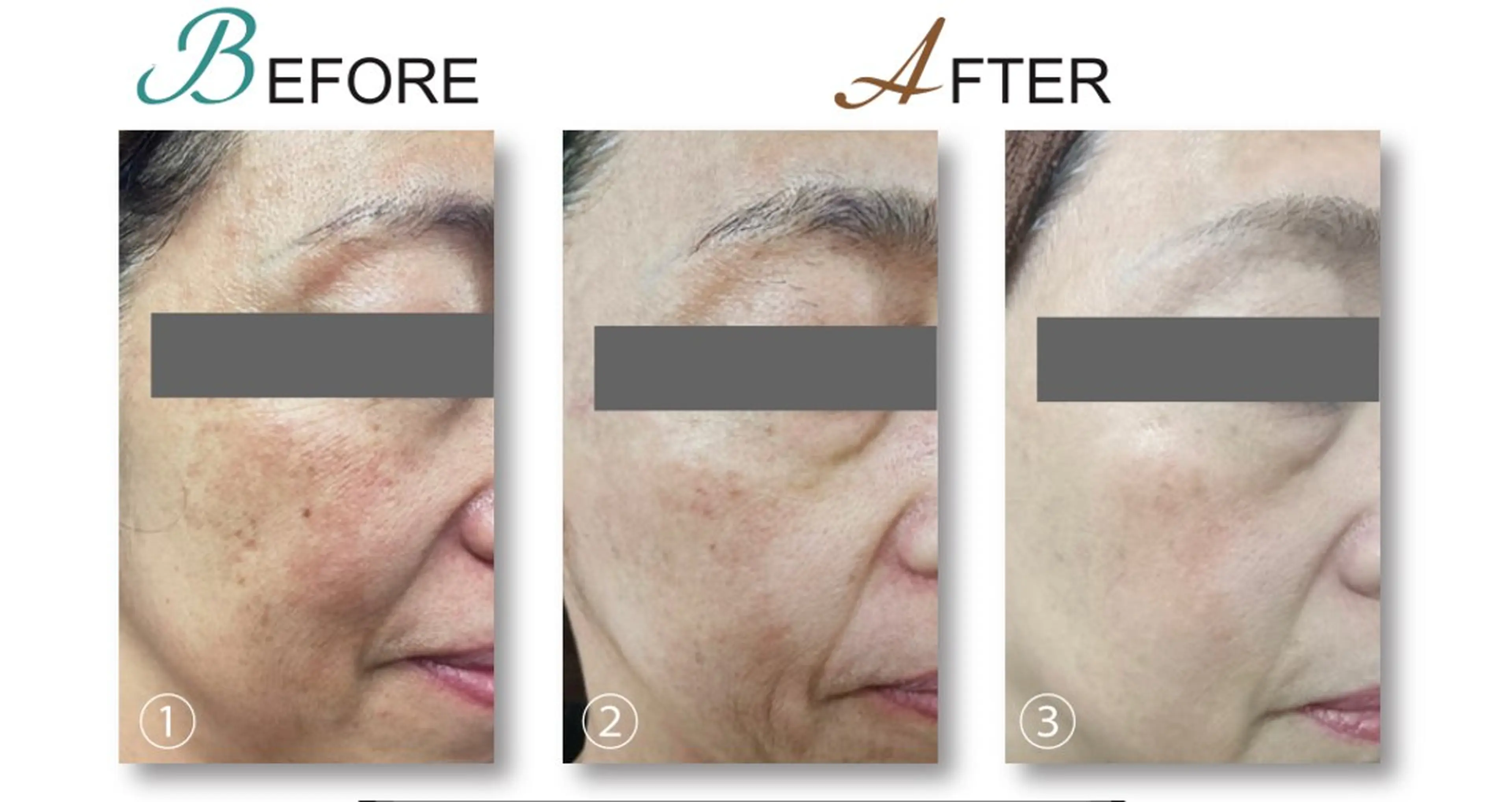 NAYU/レディース 眉毛/堺筋本町の眉毛・アイブロウイメージ