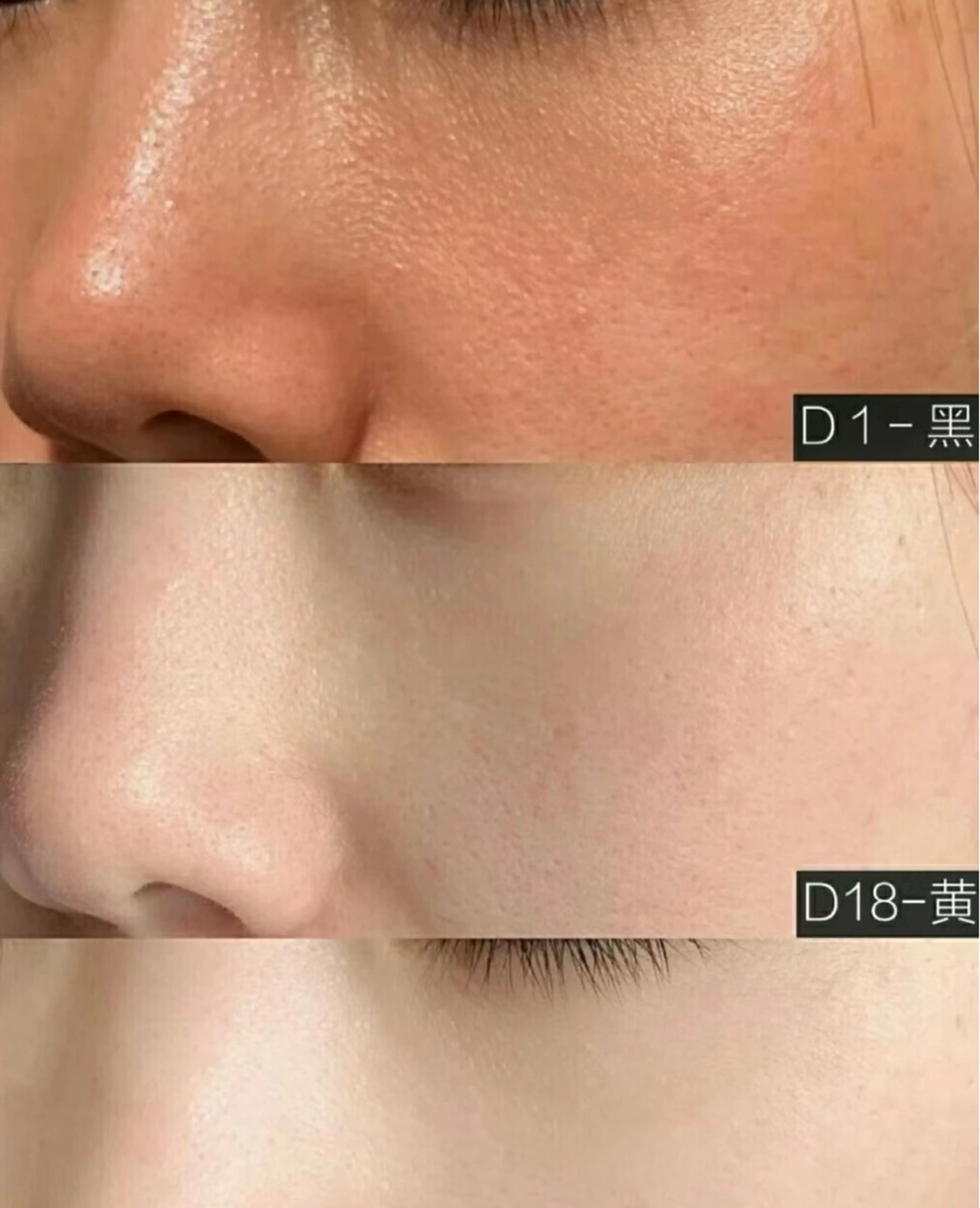 マツエク・マツパ エステ aliaハイフ&水光ジェットサロン所属・aliaハーブ水光店 エステティシャン募集のエステ・リラクイメージ