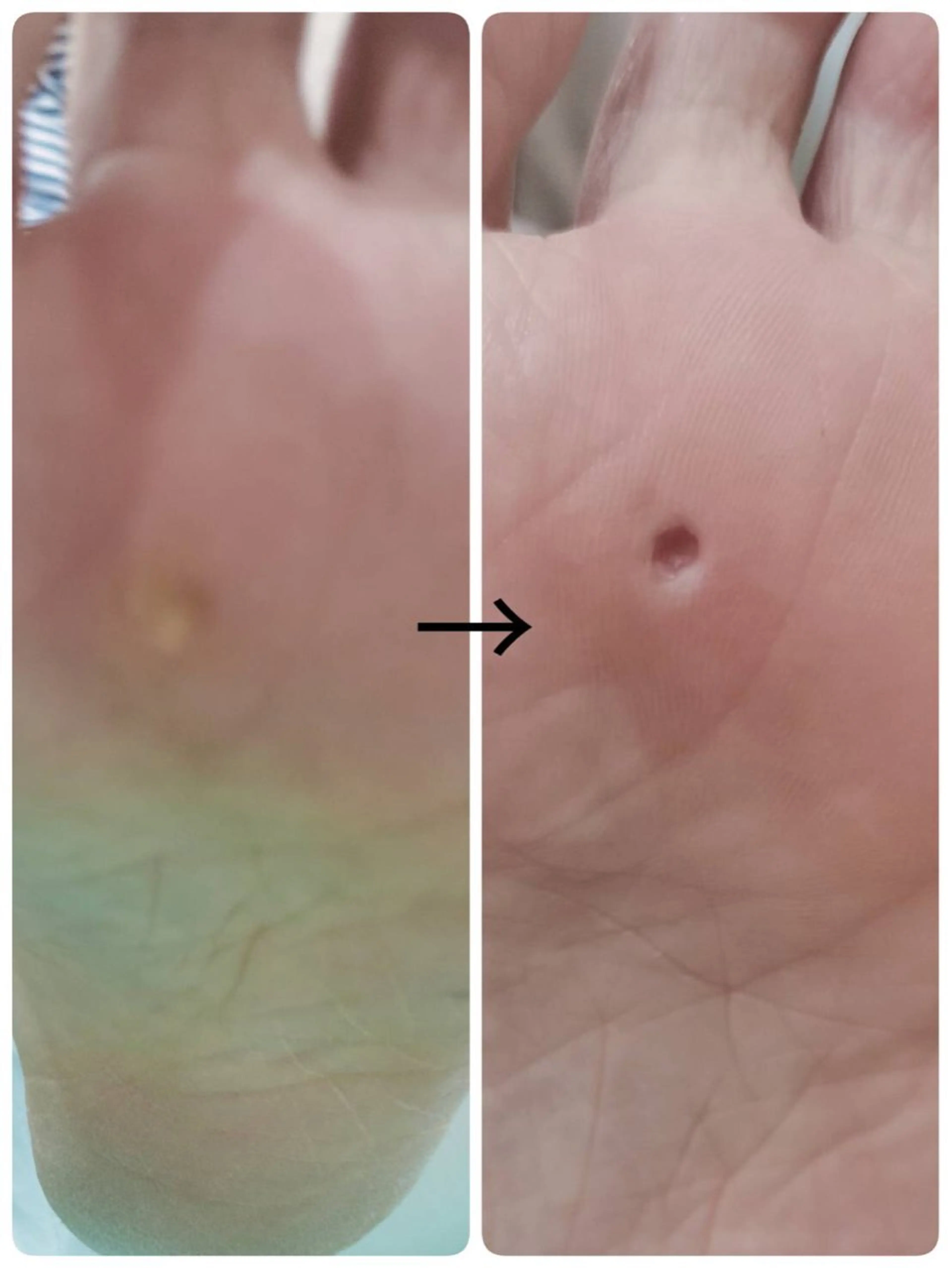 ネイル その他(ネイル) e.nail所属・和賀井 恵理のネイルデザイン