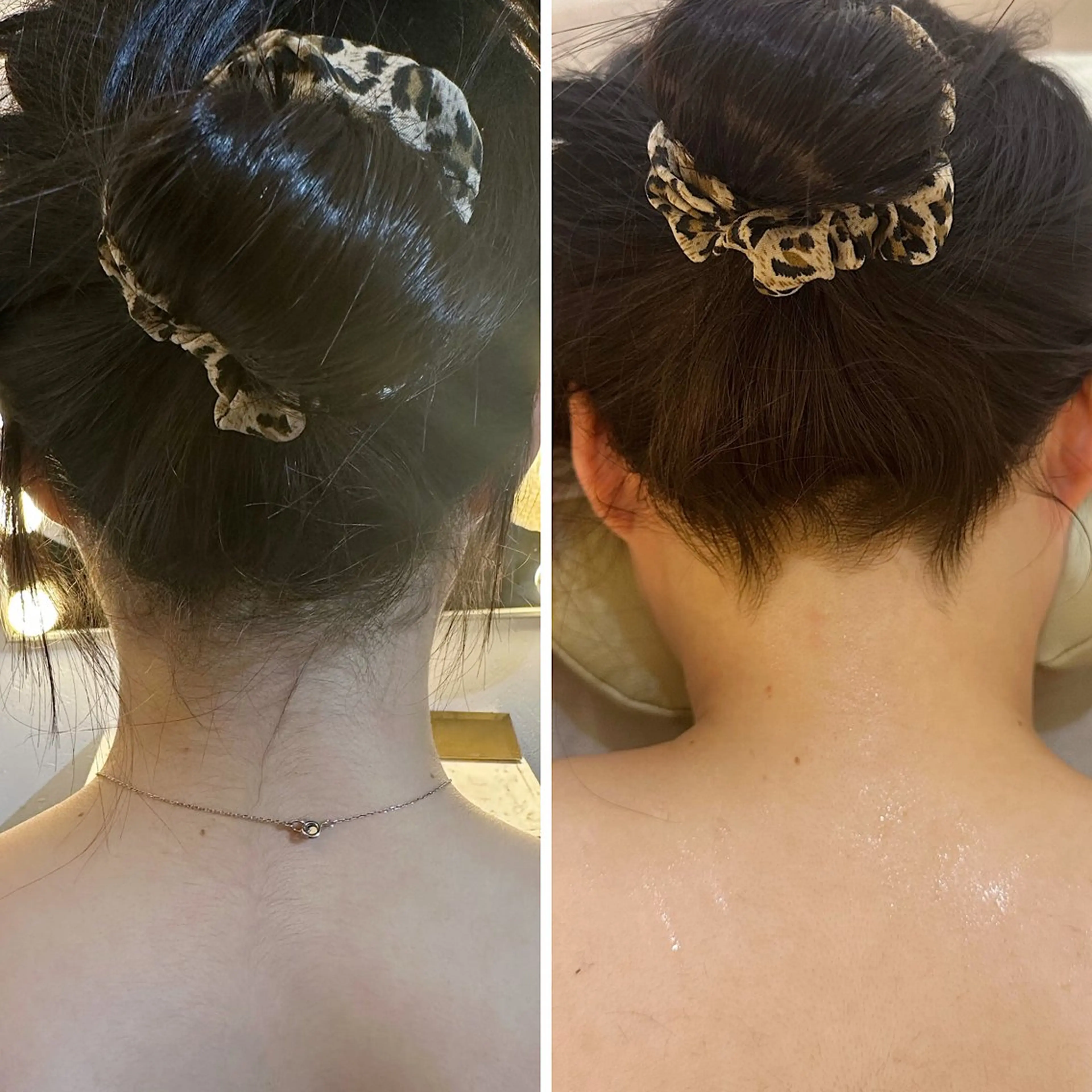 脱毛 うなじ脱毛/美肌脱毛 LABELのエステ・リラクイメージ