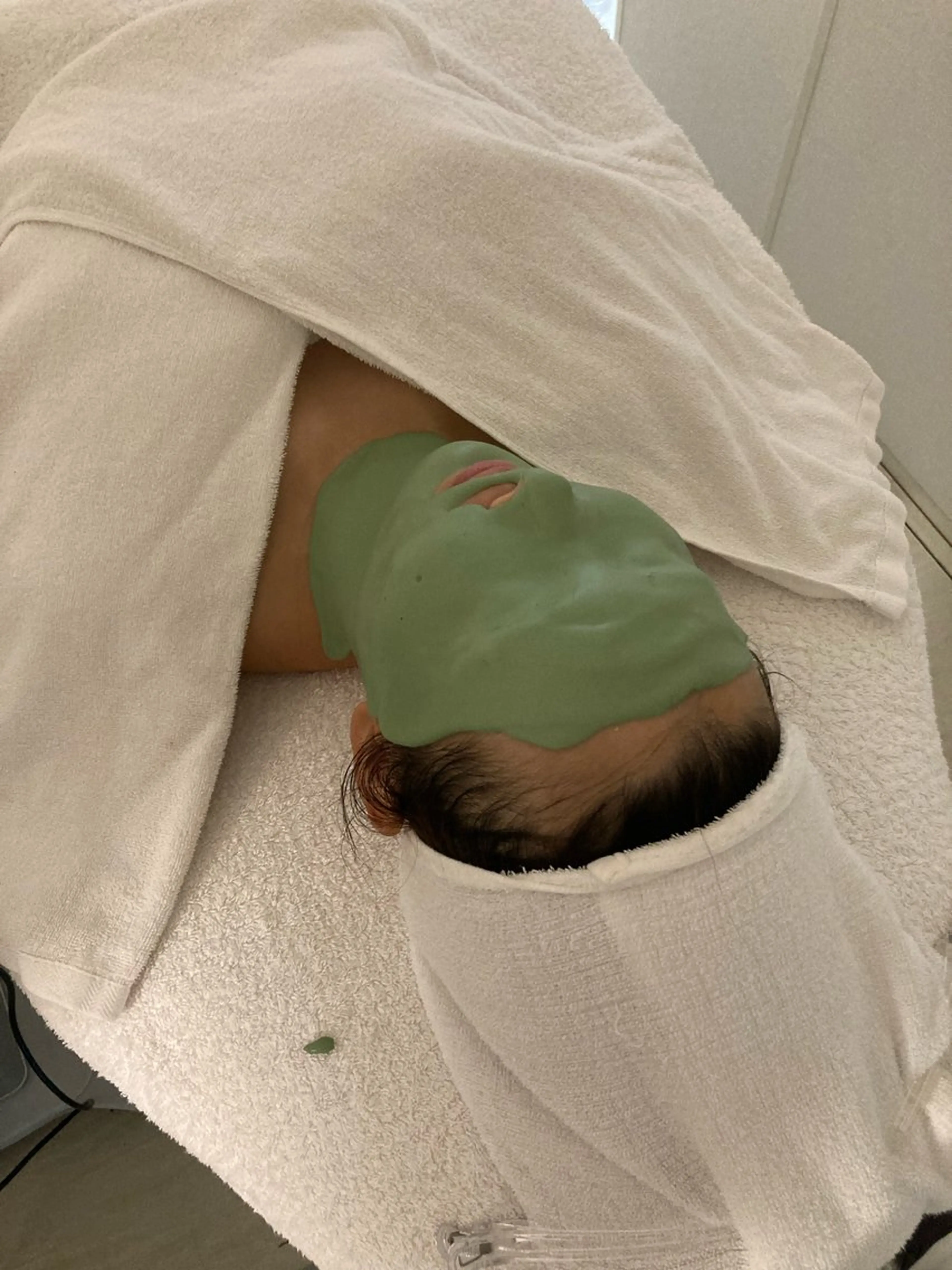 ニキビや肌荒れが気になる方に🌿赤みのでにくいお肌へアドバンスコース+ビューネケアパックの写真