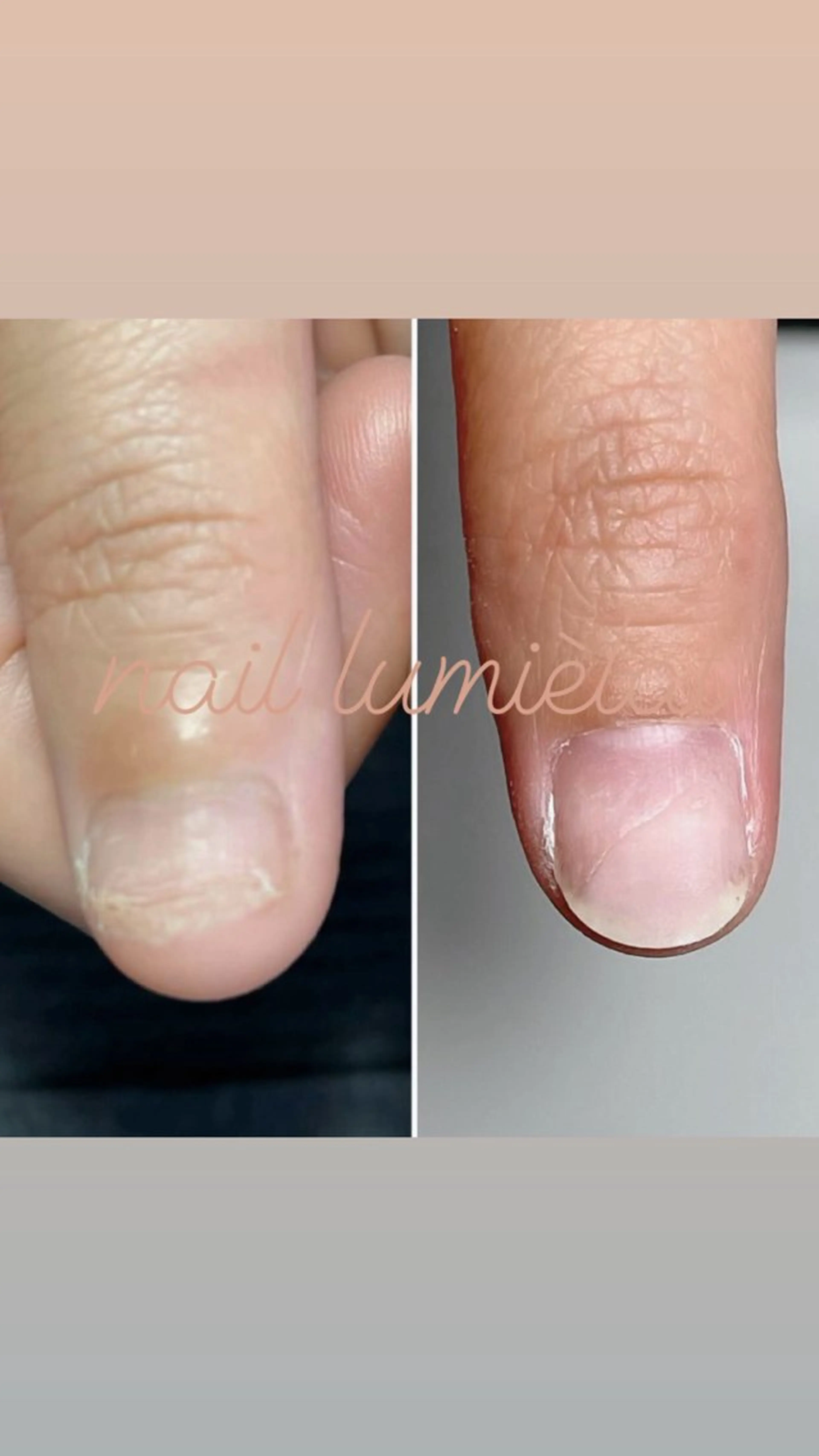 ネイル 深爪育成専門nail _Lumièlatのネイルデザイン