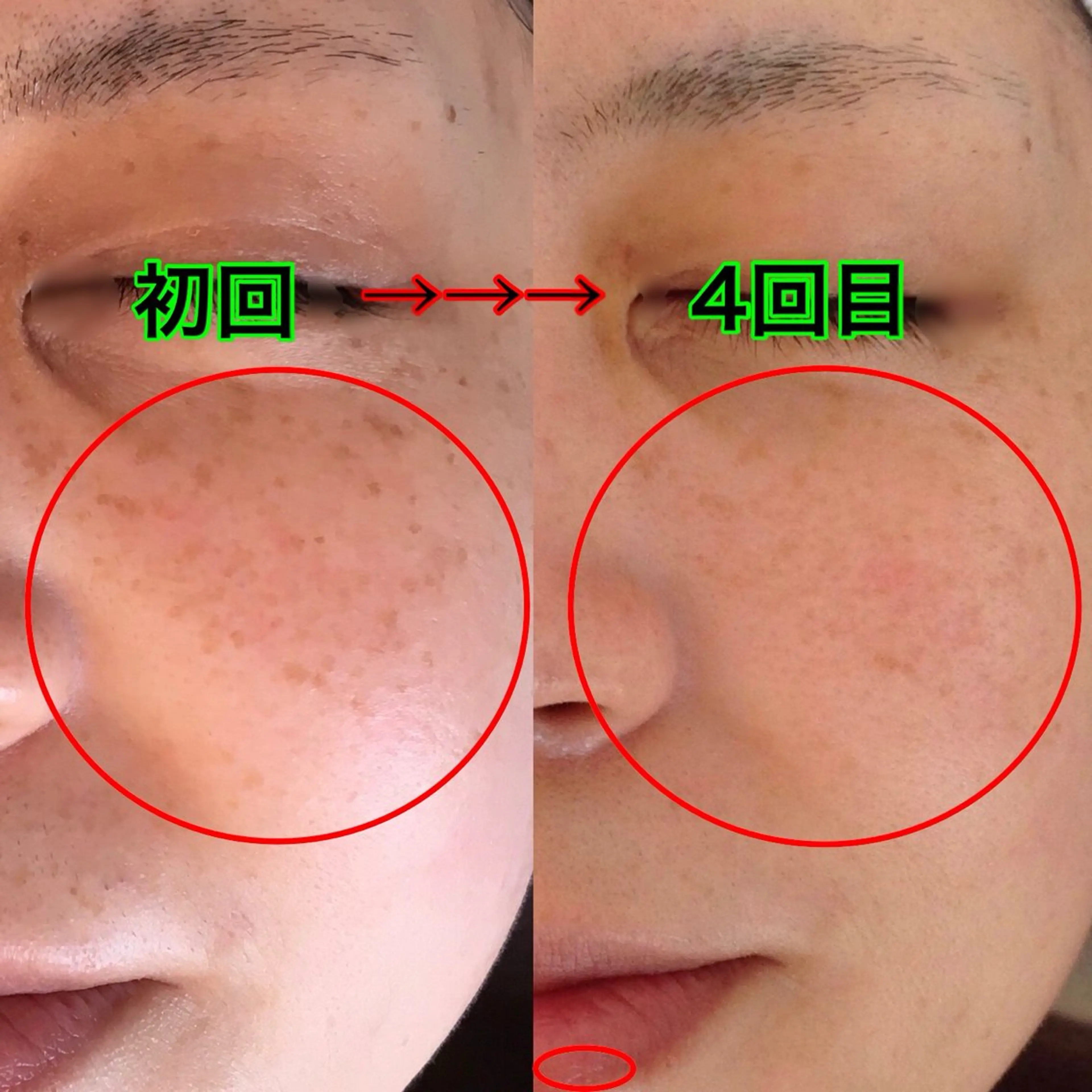 エステ vary  clue MISAのエステ・リラクイメージ