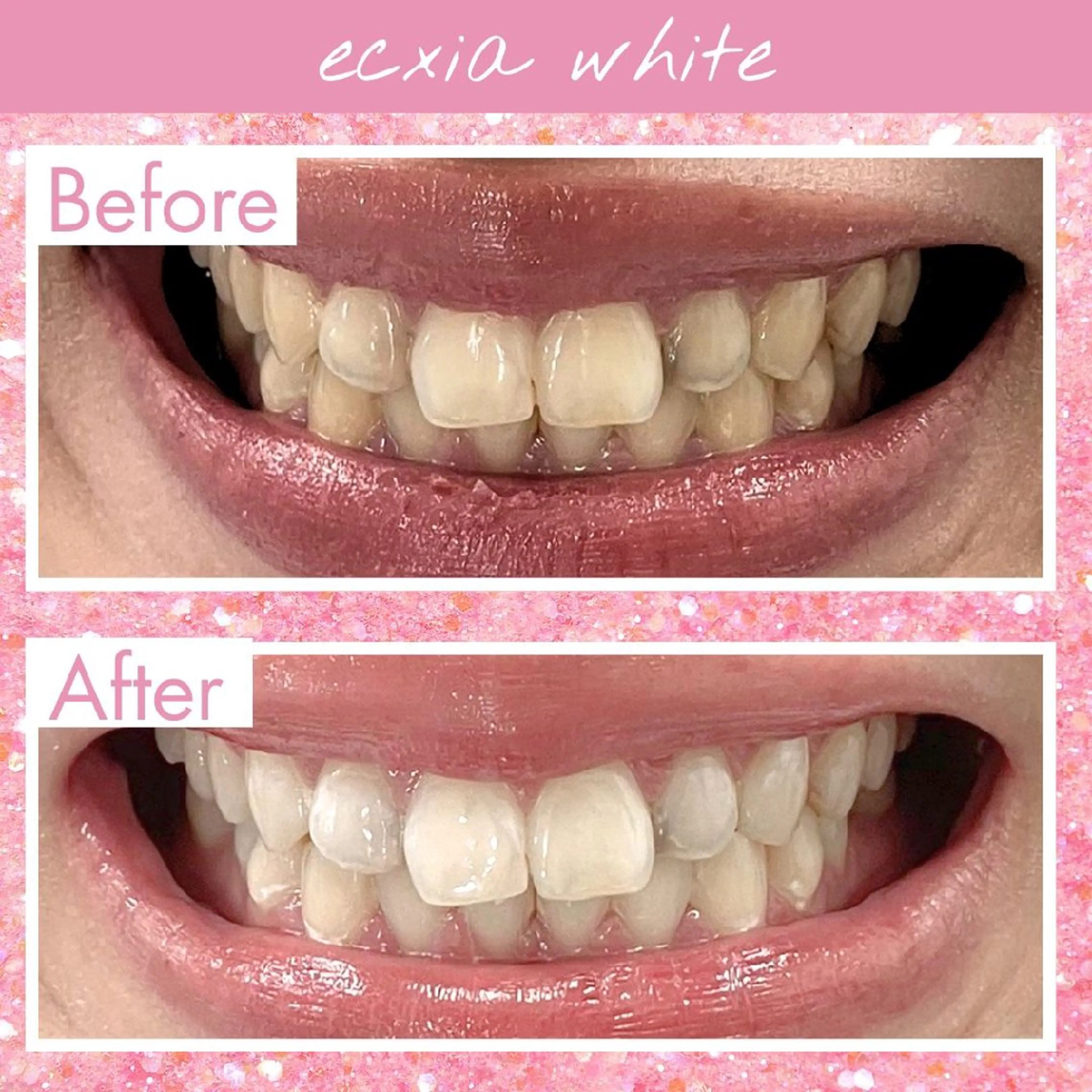 セルフホワイトニングエクシアホワイト草加店所属・セルフホワイトニング エクシア草加店のその他イメージ