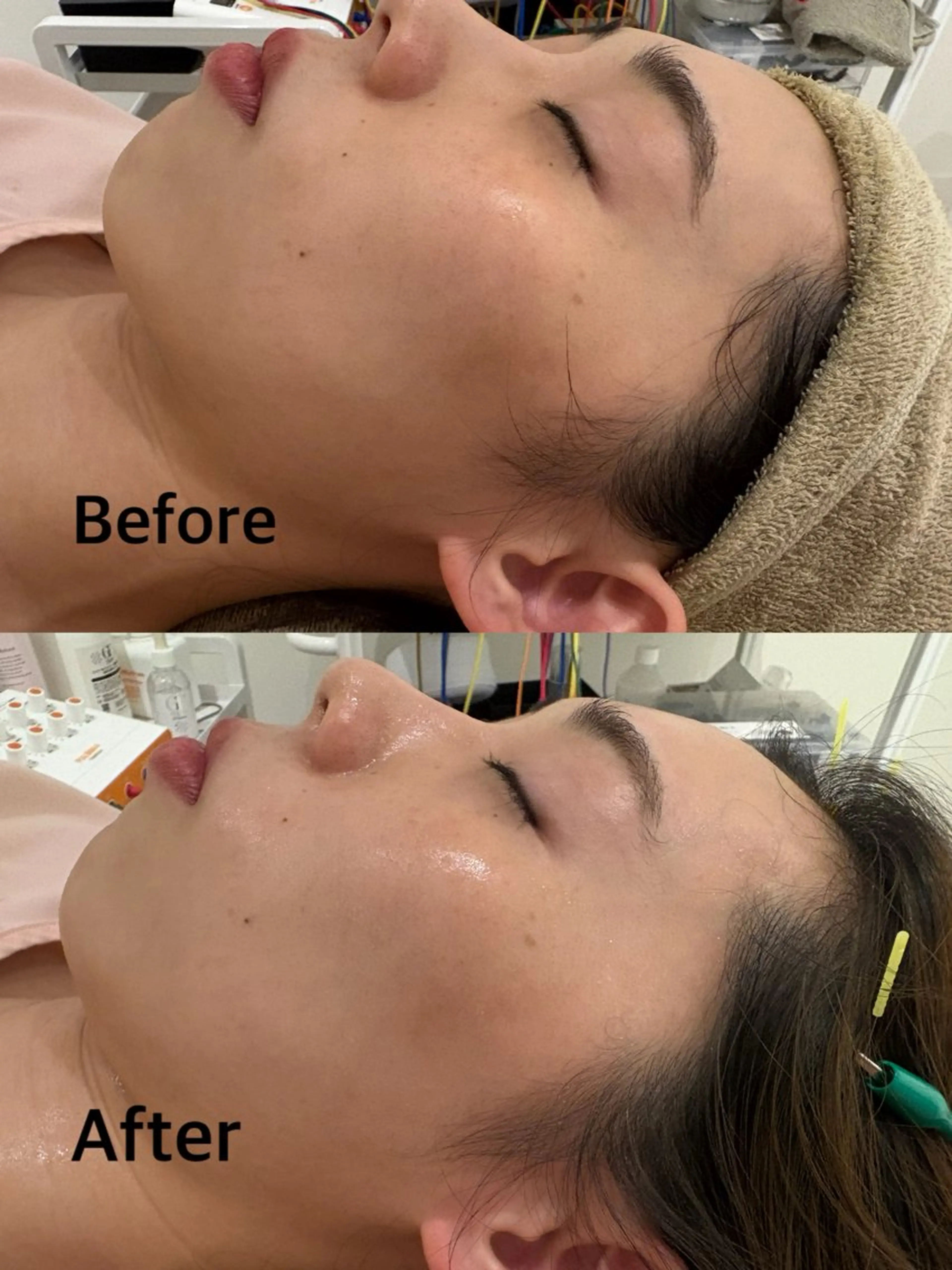 鍼灸サロン mahorobaトモのエステ・リラクイメージ