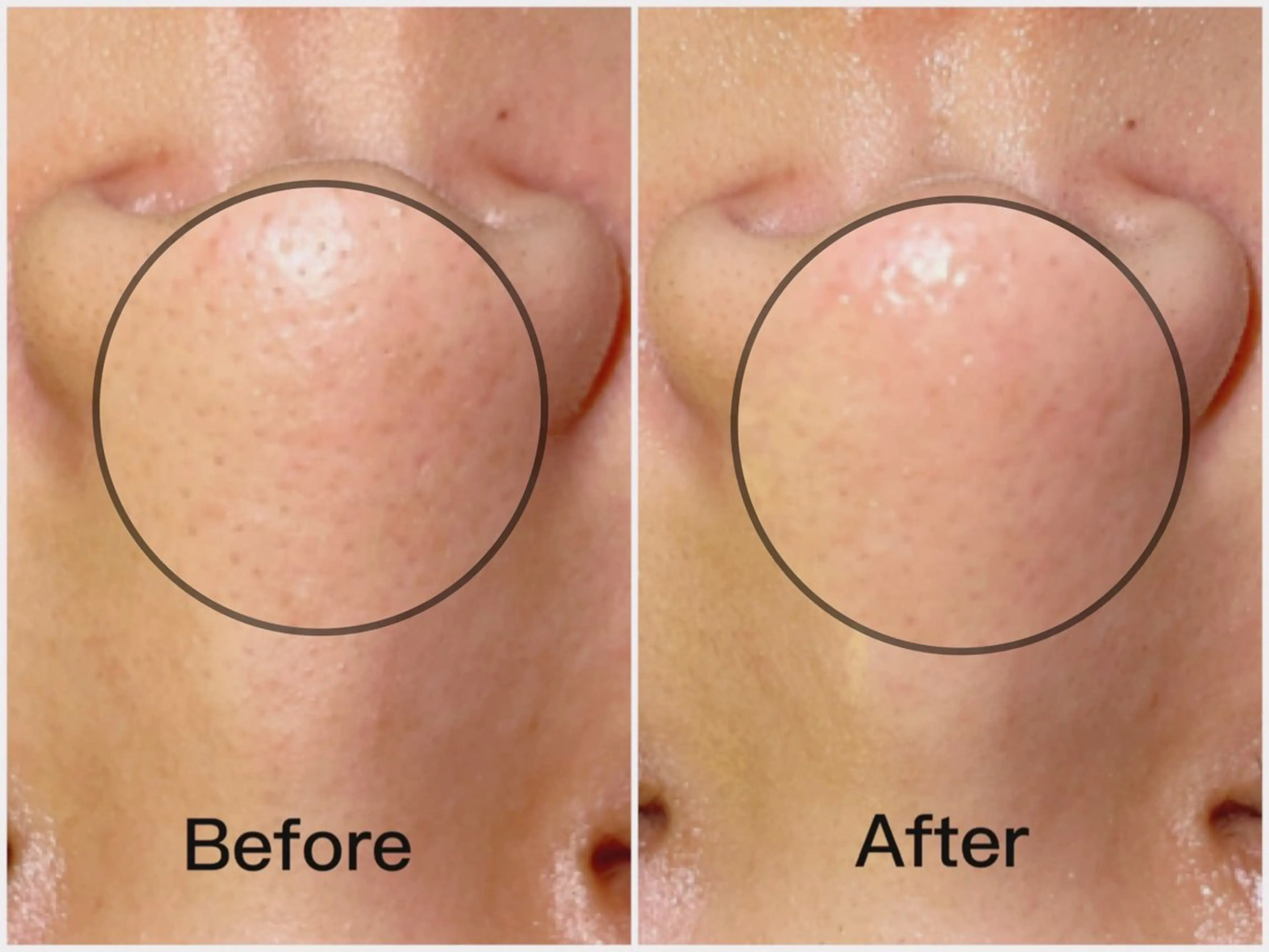 エステ SELF  BEAUTY gracia浦添店所属・gracia 浦添店のその他イメージ