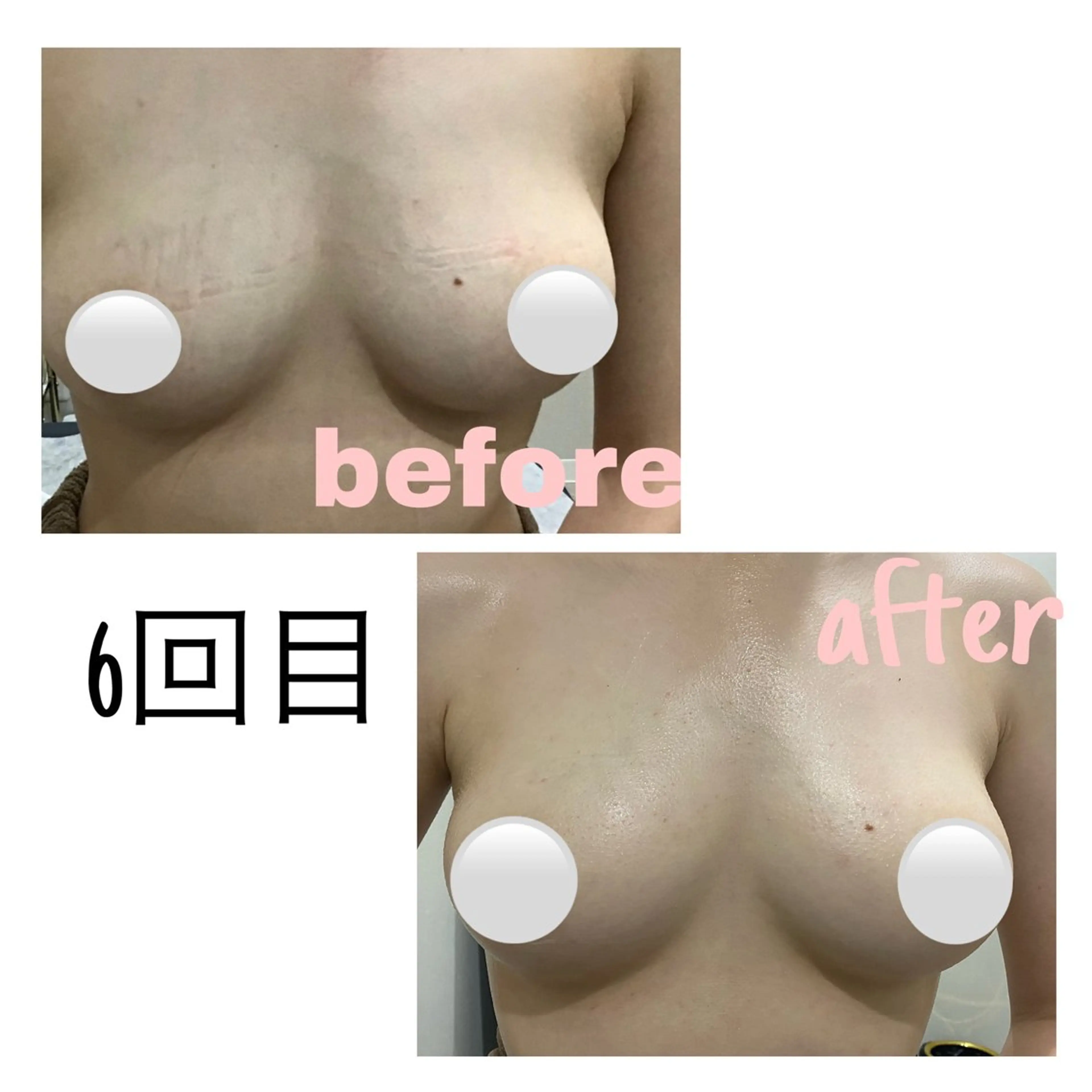 エステ 毛穴洗浄・痩身・脱毛 /アルカンジュのエステ・リラクイメージ