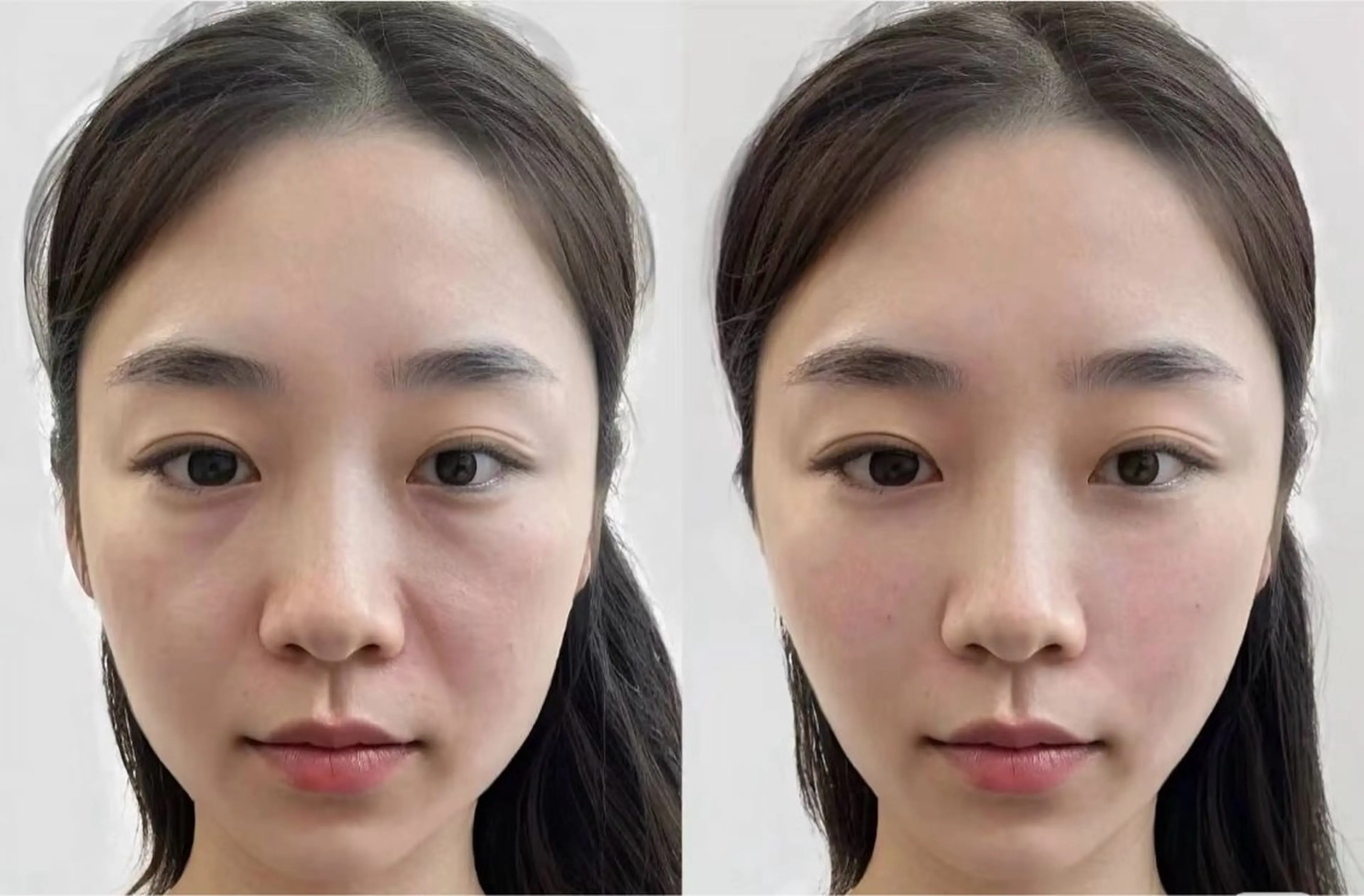 ネイル エステ aliaハイフ&水光ジェットサロン所属・aliaハーブ水光店 エステティシャン募集のエステ・リラクイメージ