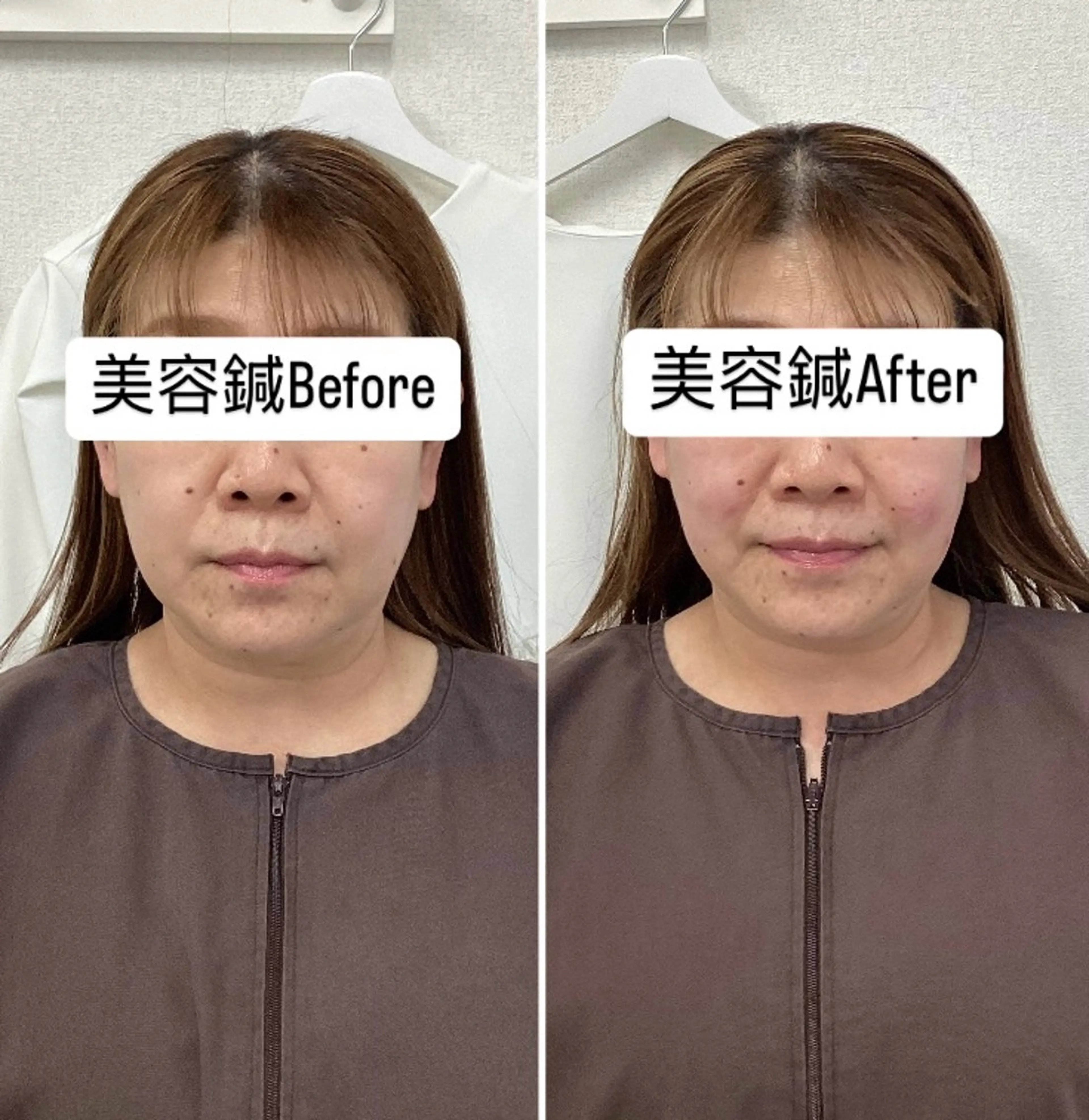 エステ リラク hari salon de off　美容鍼灸×小顔整体【ハリサロンドオフ】所属・美容鍼灸×小顔整体♡ ハリサロンドオフ堺東のエステ・リラクイメージ