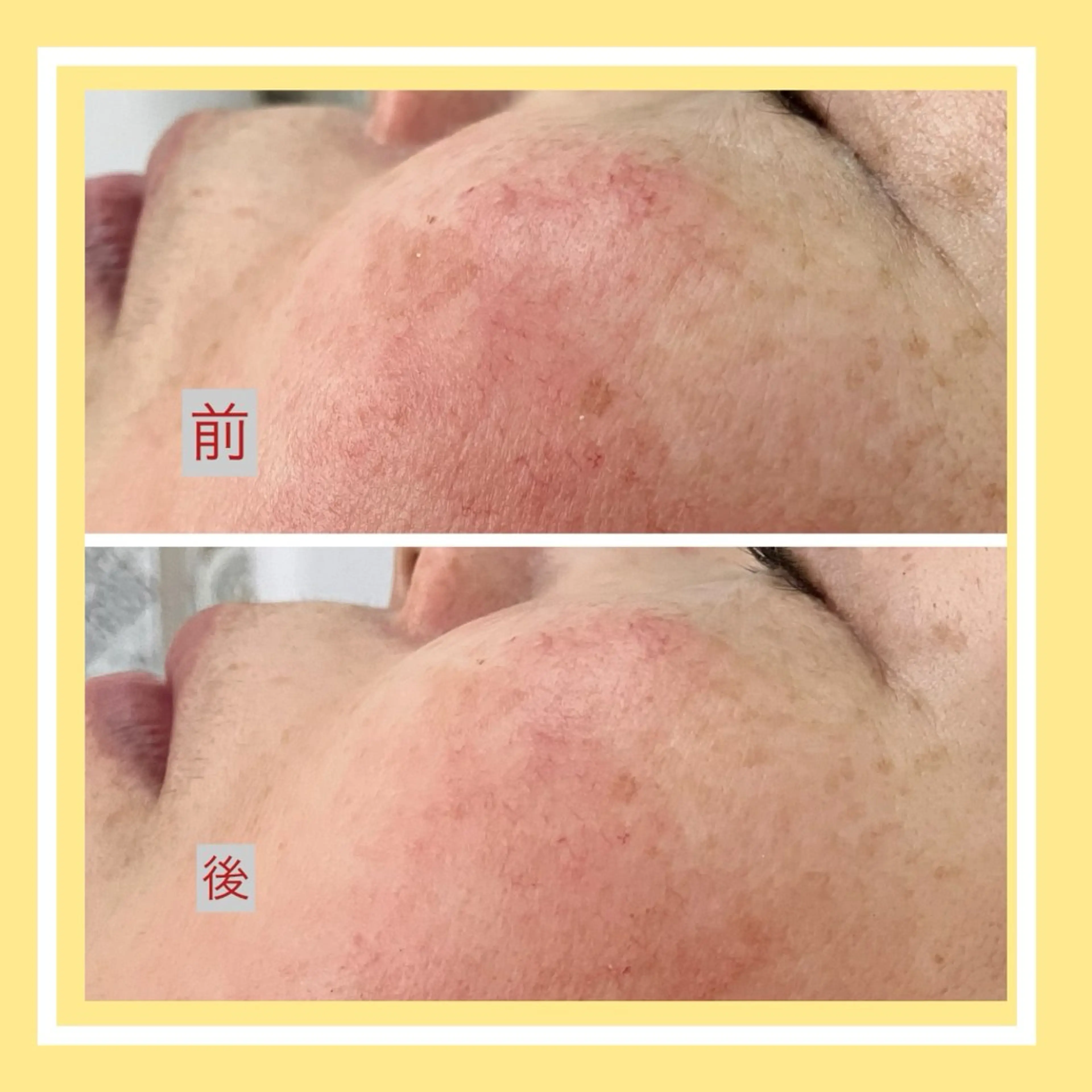 その他 たるみ改善小顔エステ 堀葉月のその他イメージ