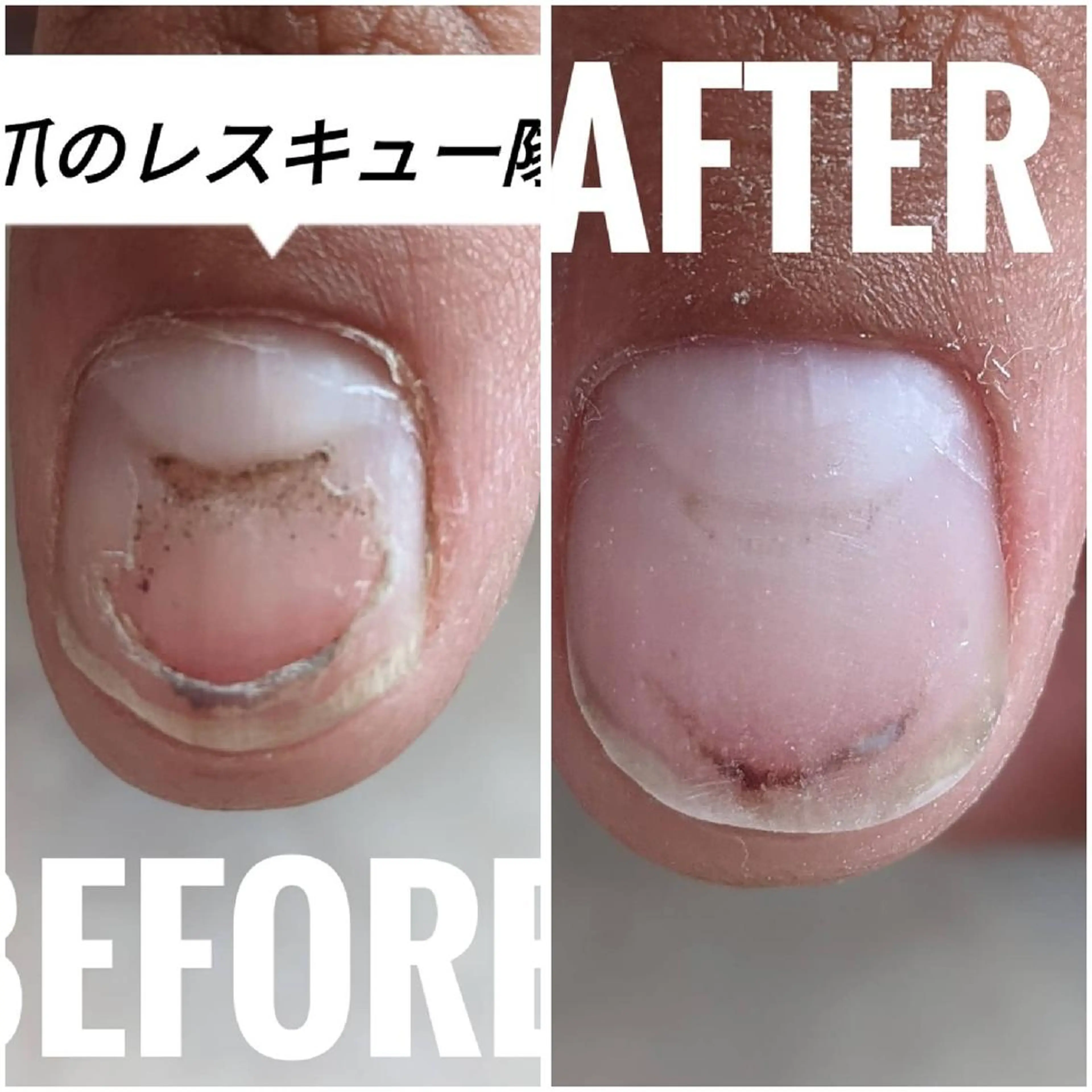 ネイル HAPPY HAPPYのネイルデザイン