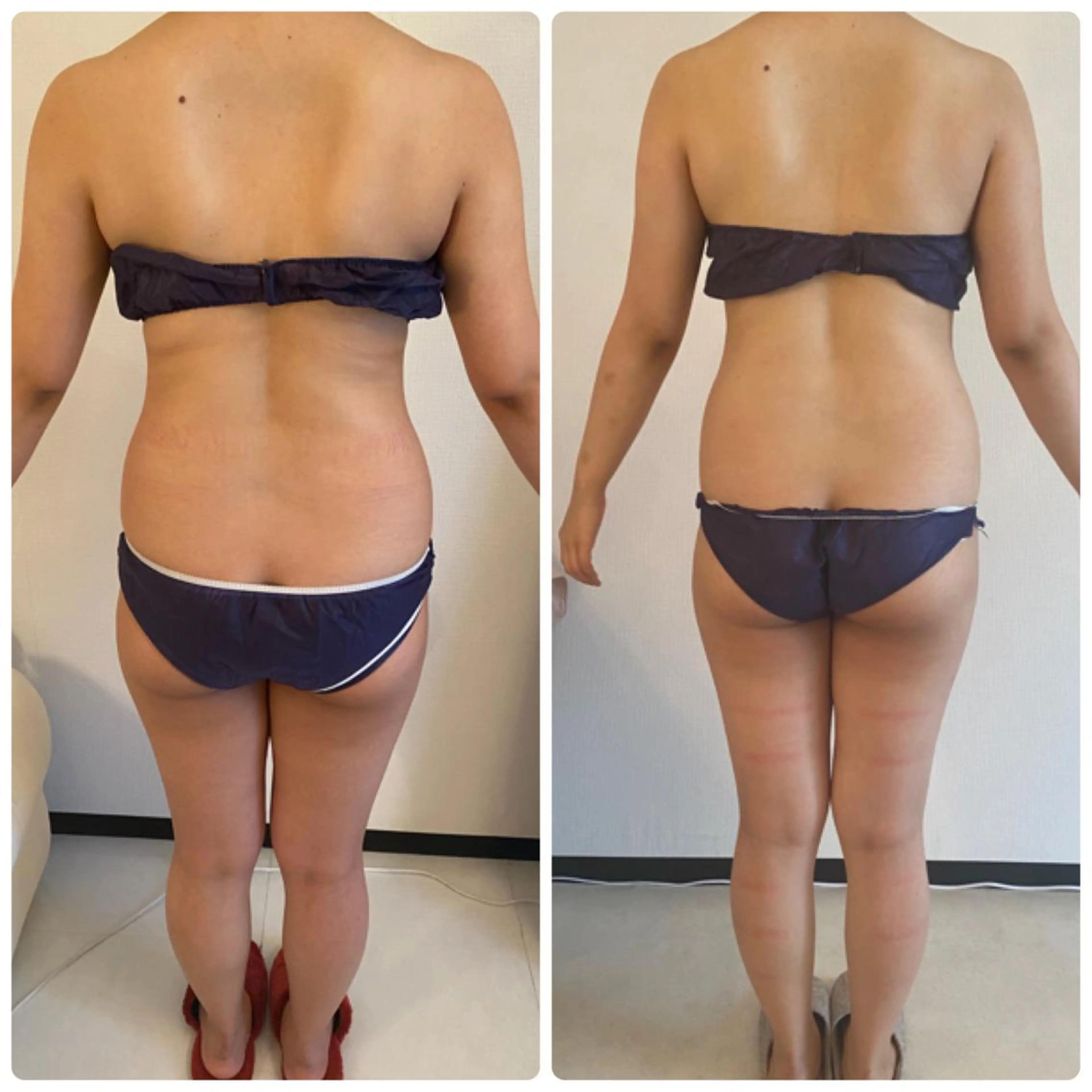 FLEUR大阪・美容 整体・痩身・小顔のエステ・リラクイメージ