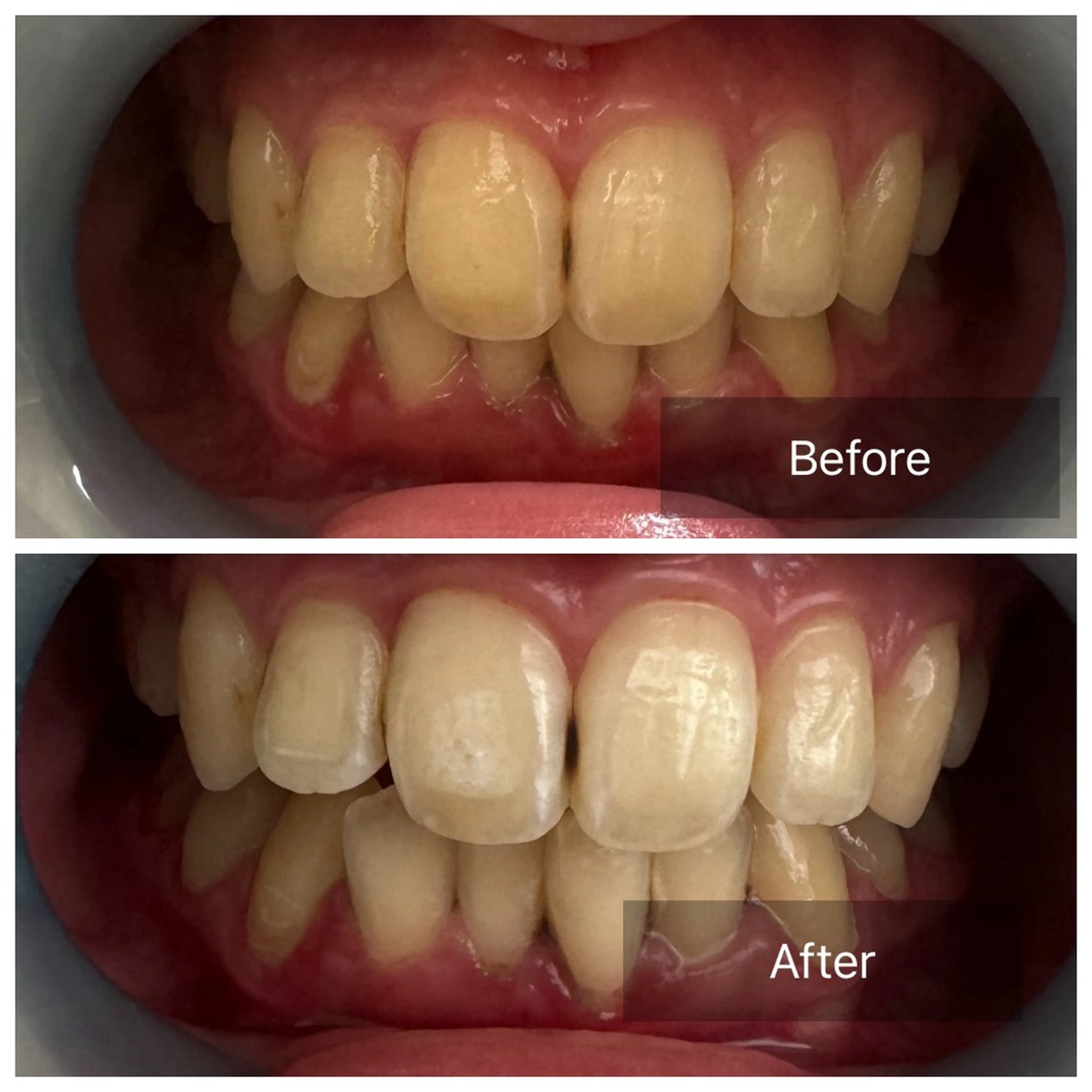 Ocouture所属・Ocouture ホワイトニング、小顔のその他イメージ