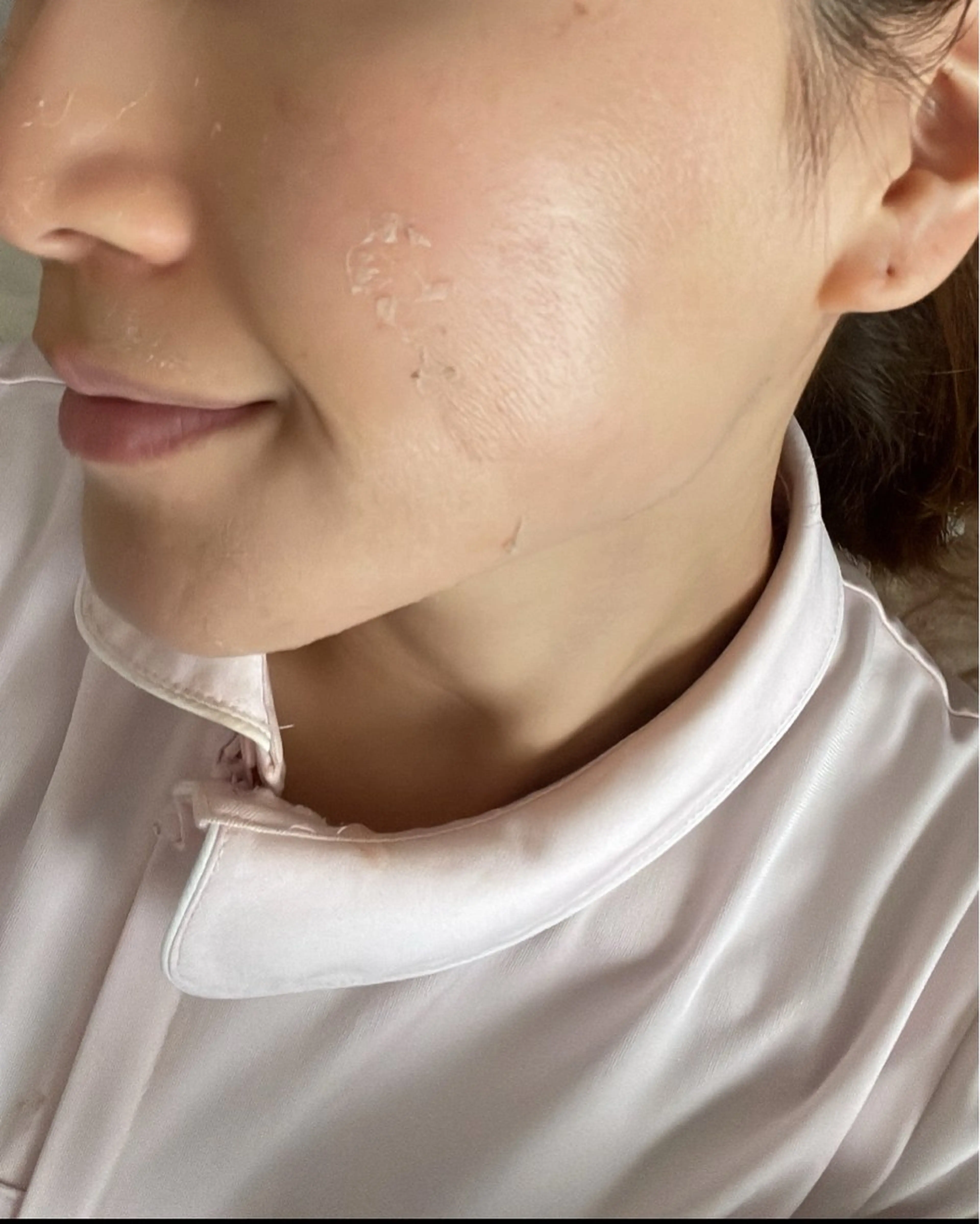 brilliance所属・老化肌トラブル肌専門 Brillianceのエステ・リラクイメージ