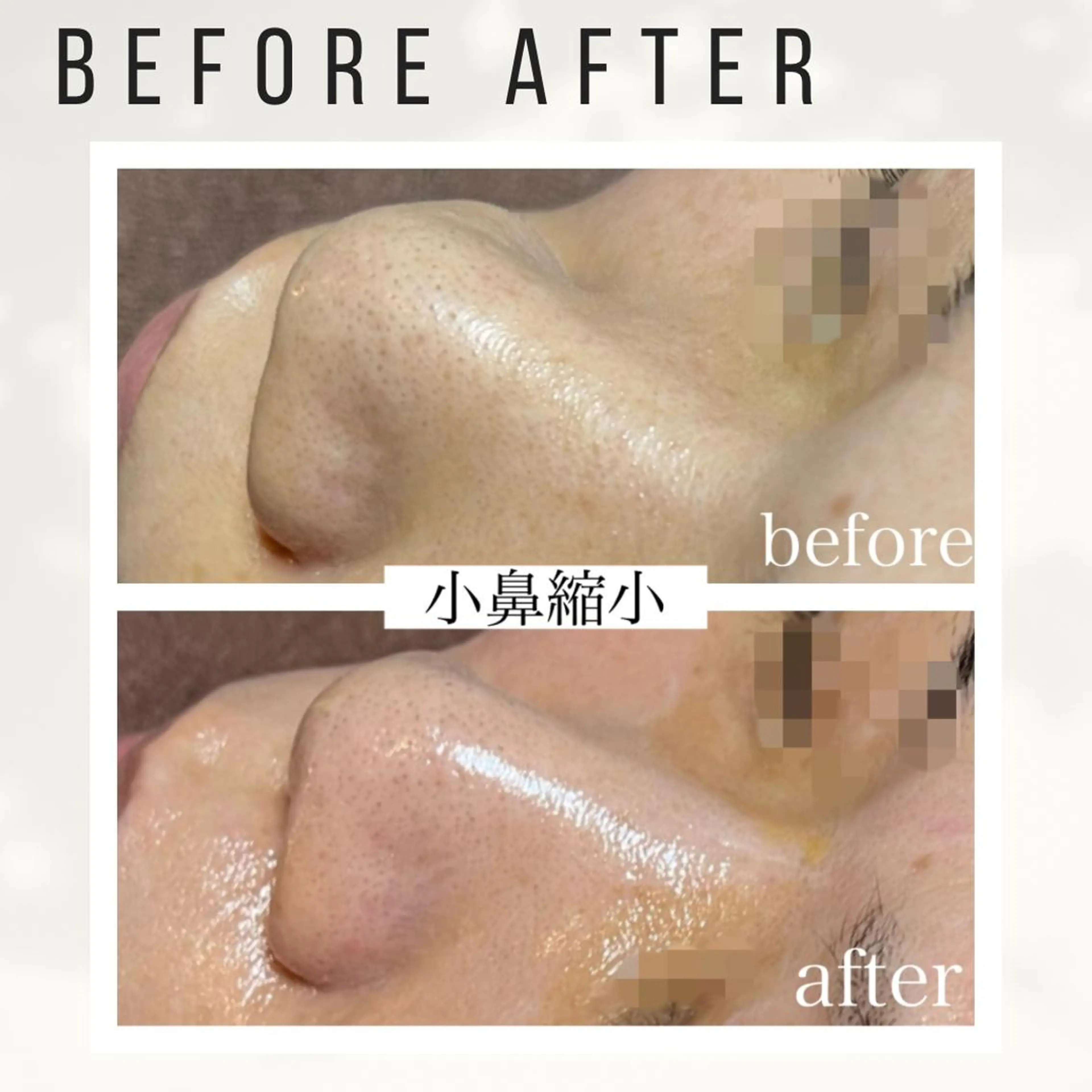 Beauty salon ハピー所属・大人女性のための 肌管理サロン　ハピーのエステ・リラクイメージ