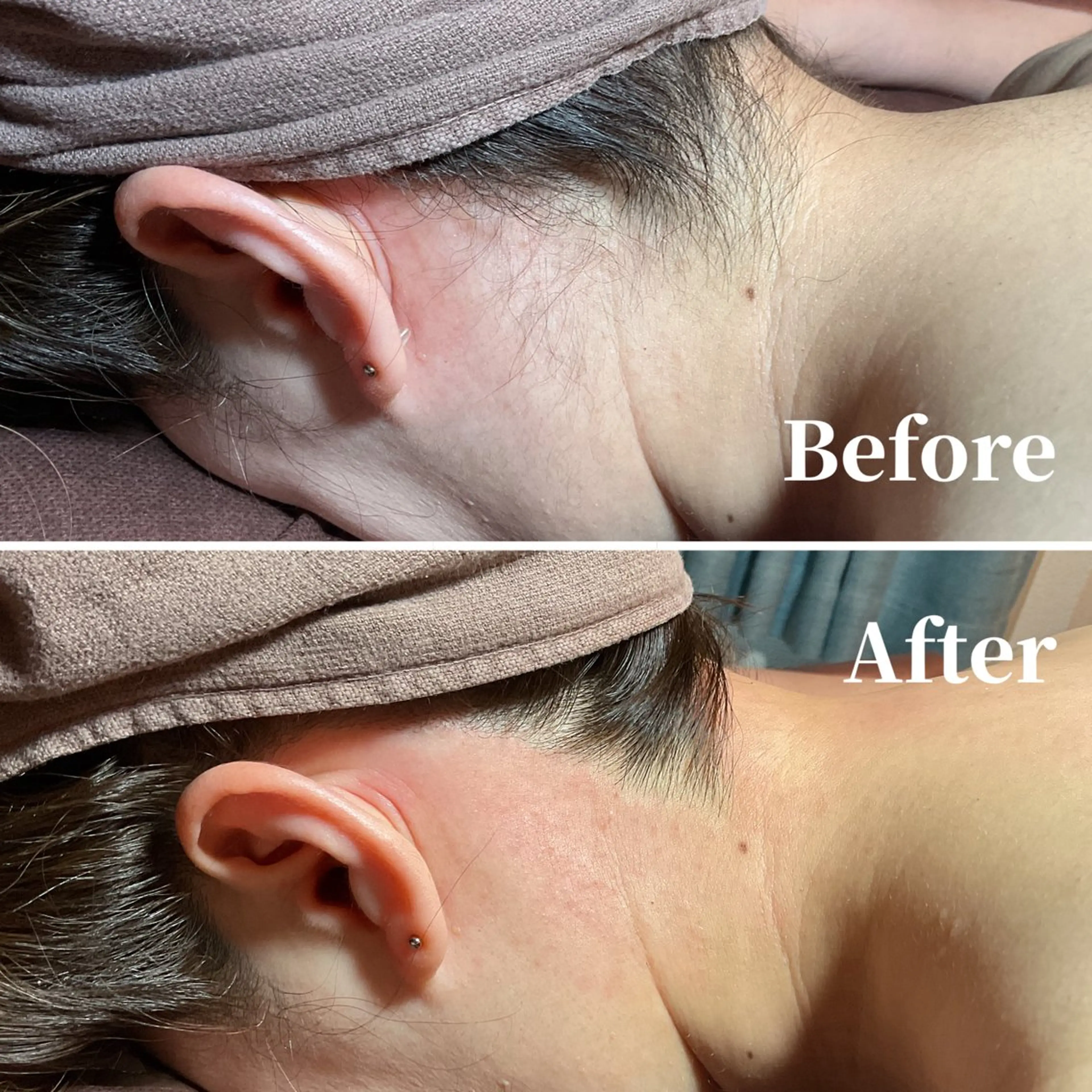 エピナス町田店 ブラジリアンワックスのエステ・リラクイメージ