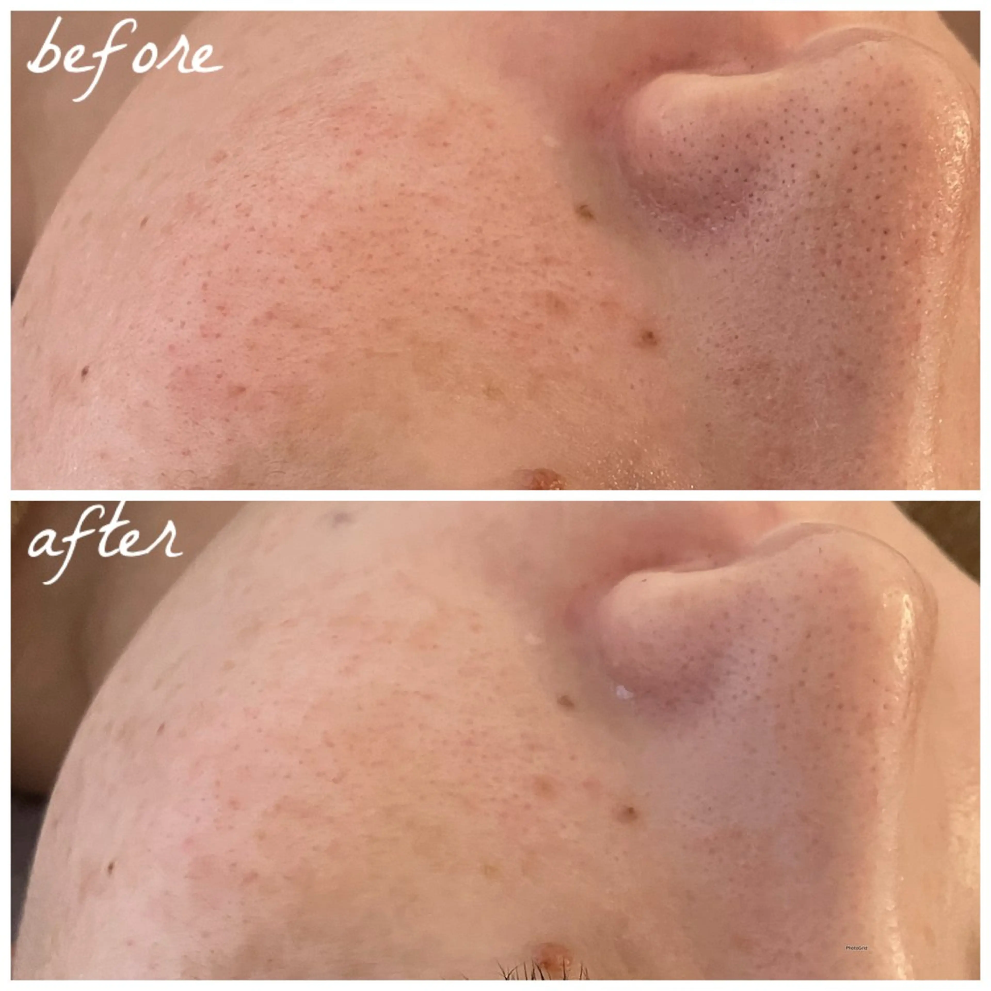 メンズ メナード岐阜市茜部 杉浦のエステ・リラクイメージ