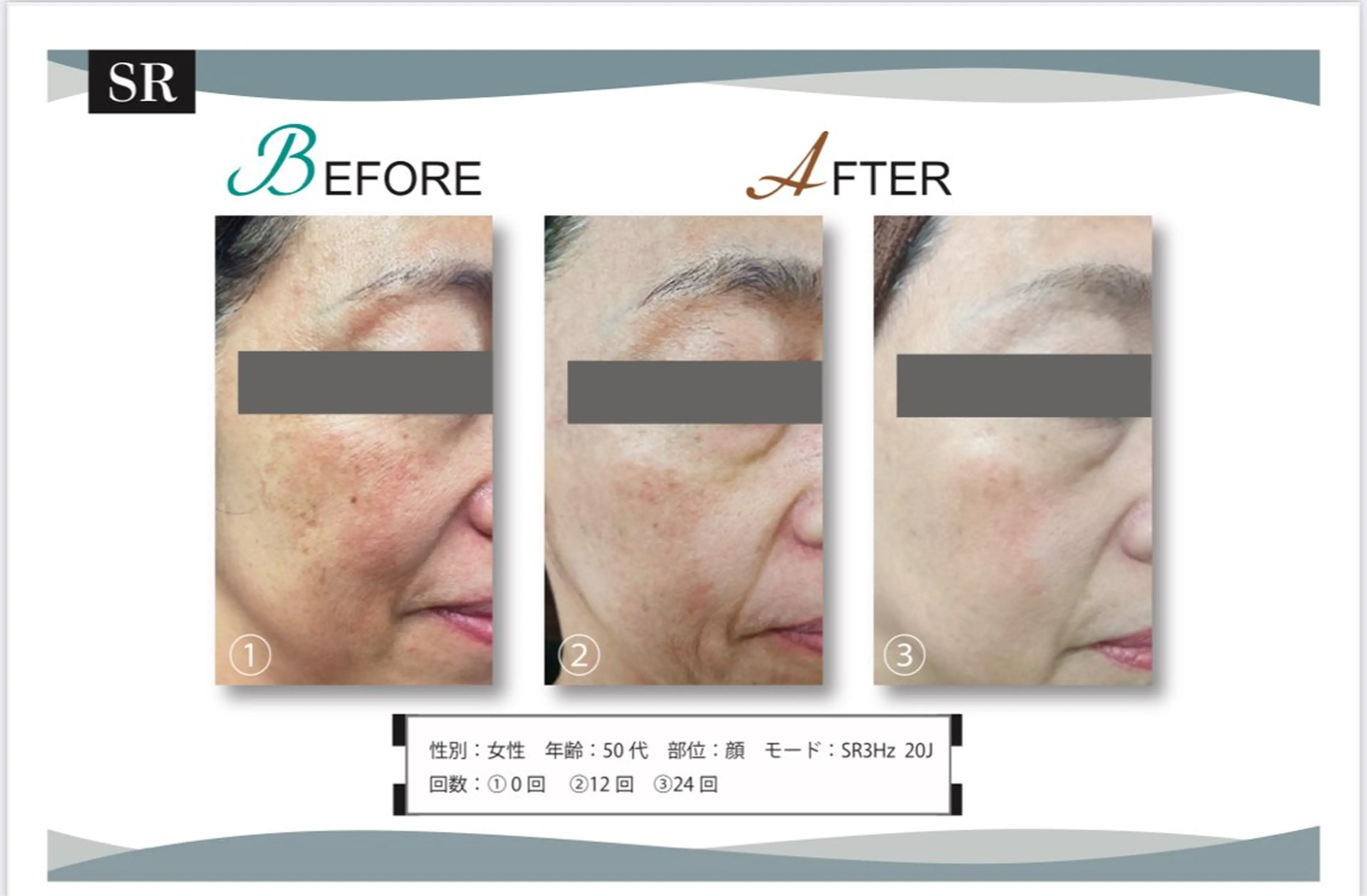 脱毛サロン　LILIAN所属・脱毛・美肌サロン LILIAN 脱石油のエステ・リラクイメージ