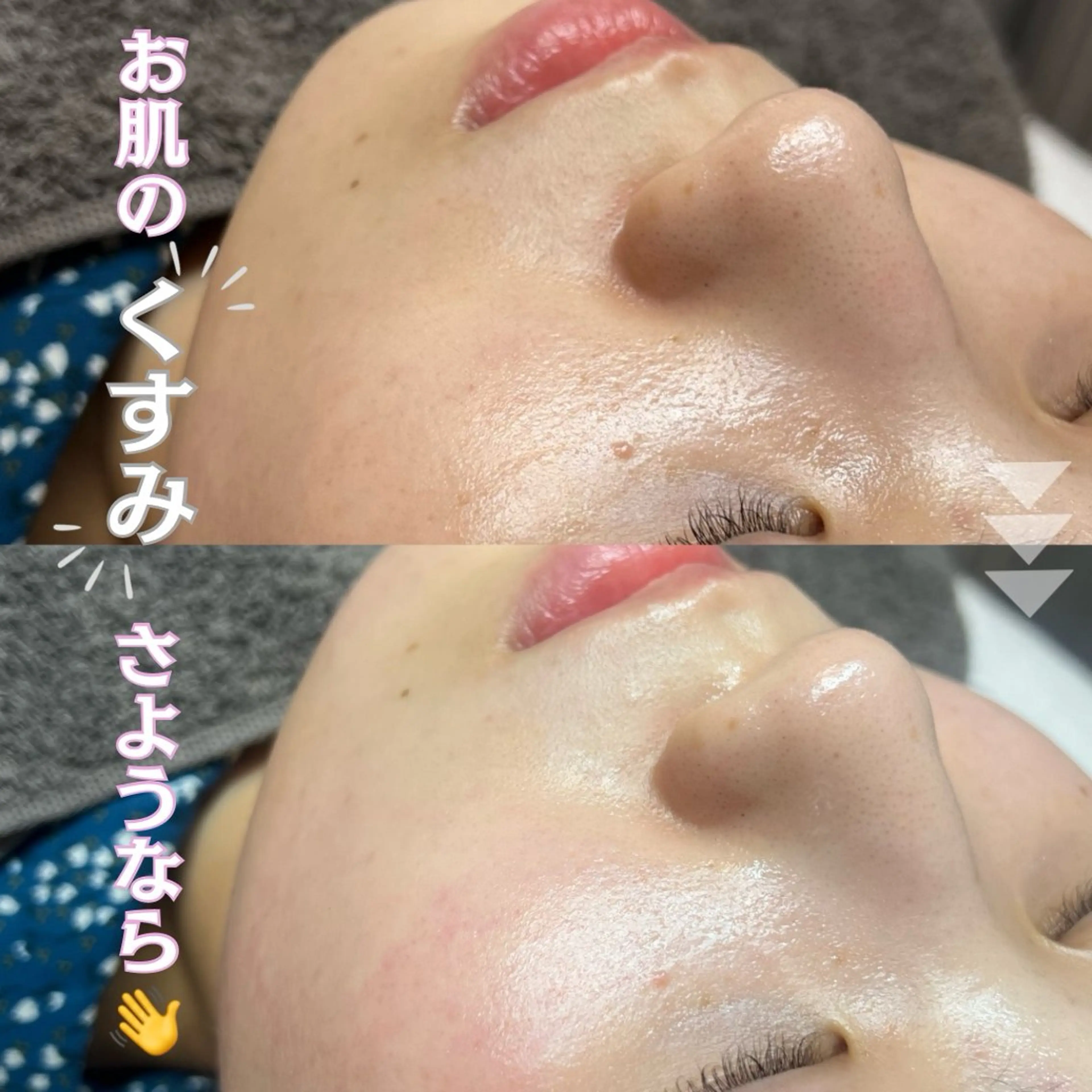 平日限定特別価格🩷全顔フェイシャルワックス🧏🏻♀️✨メンズの方も利用可能◎の写真