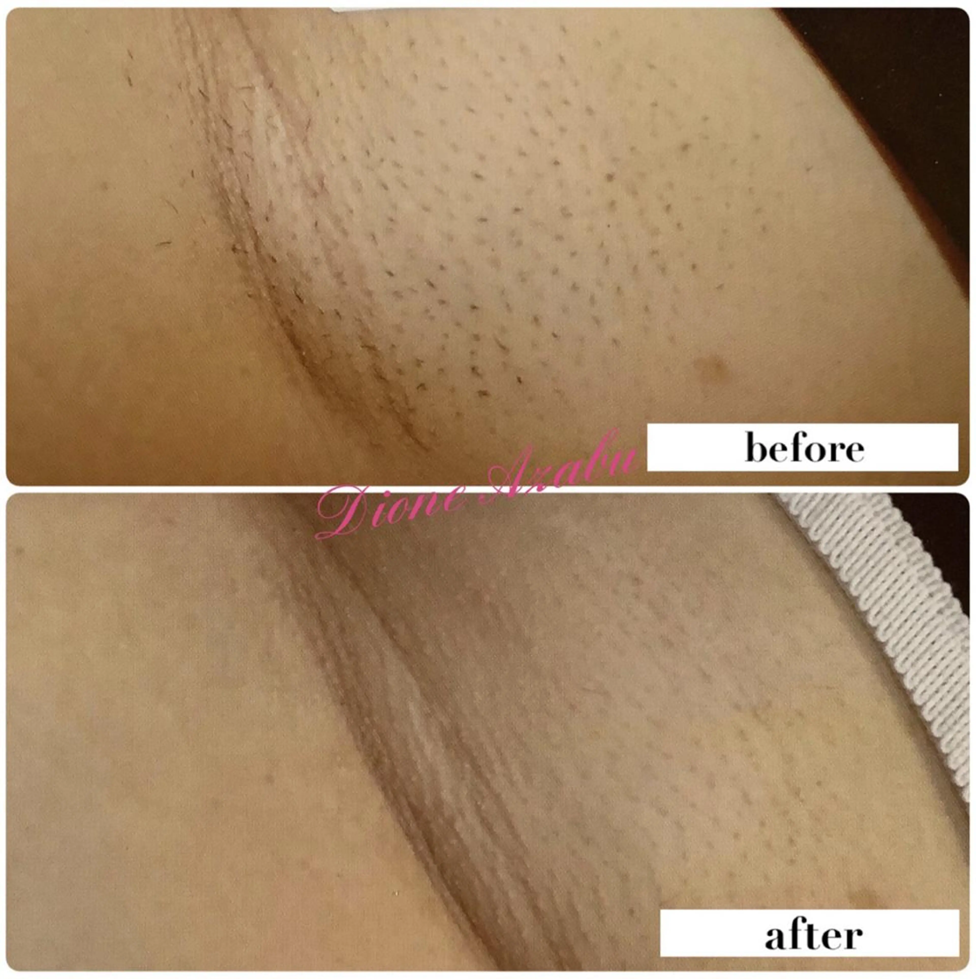 DIONE 麻布十番店のエステ・リラクイメージ