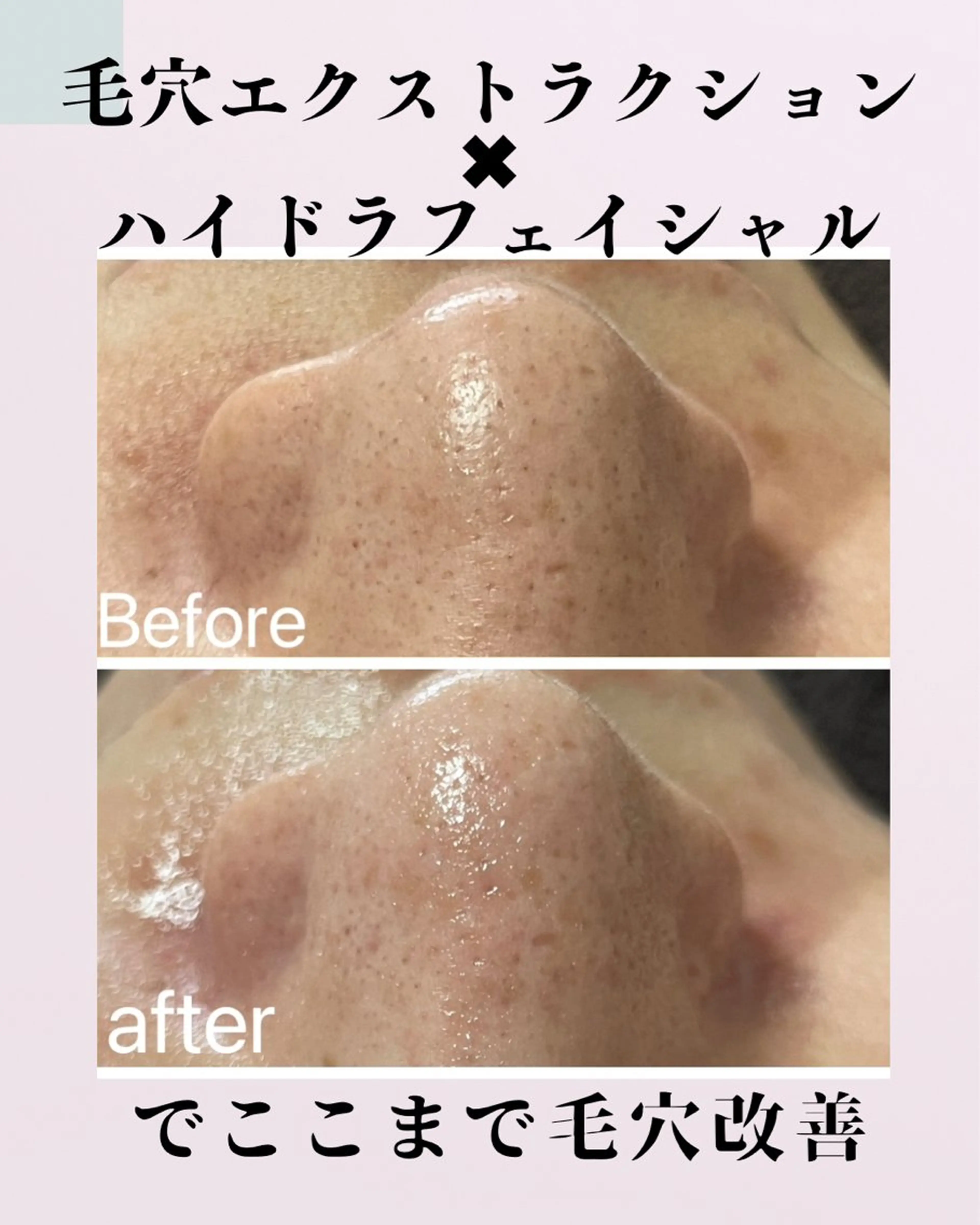 肌質改善サロン facialmoonのエステ・リラクイメージ