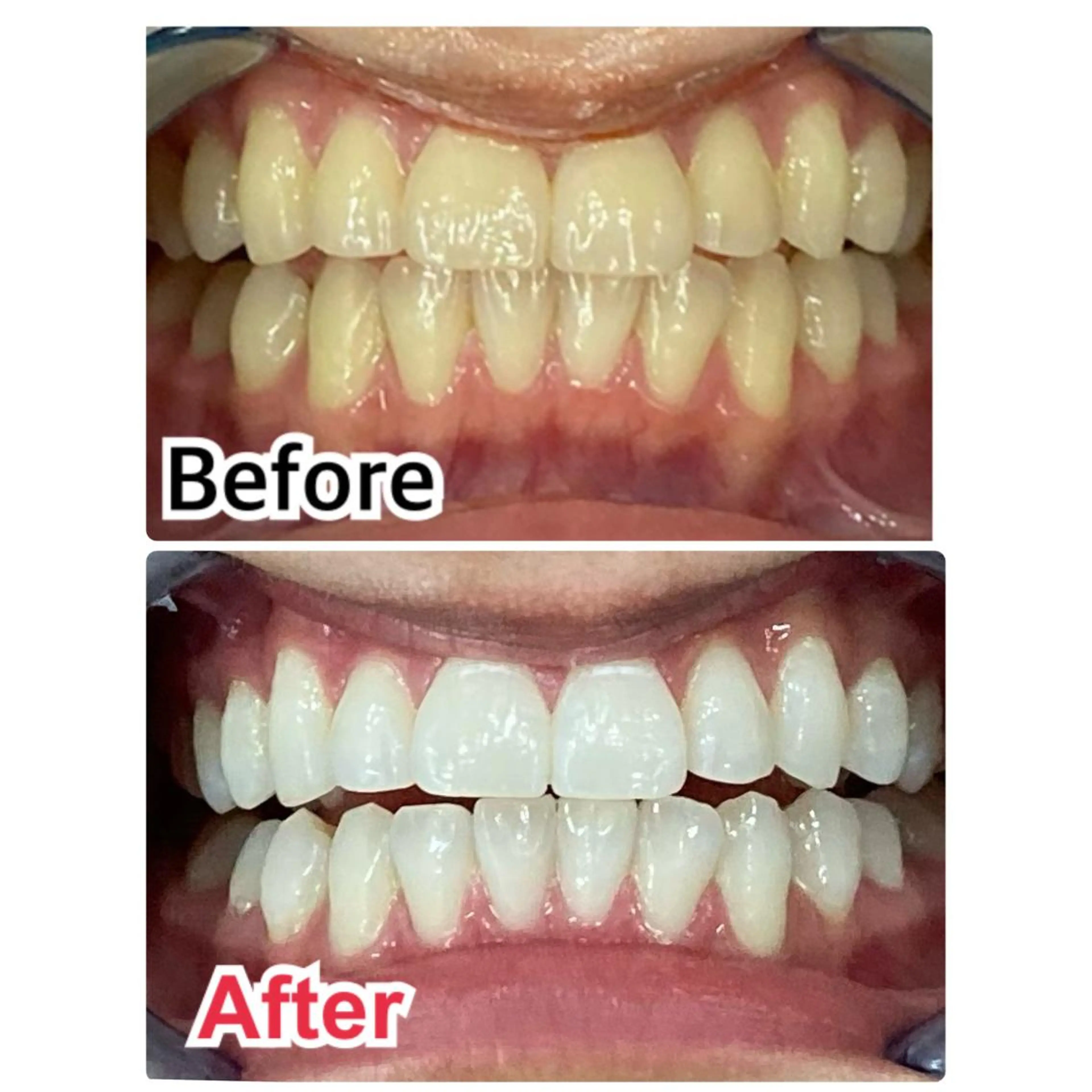 ミディアム メンズ キッズ ネイル マツエク・マツパ アイブロウ プラチナムビューティー柏所属・【歯科提携】柏ホワイ トニングスタイルのその他イメージ