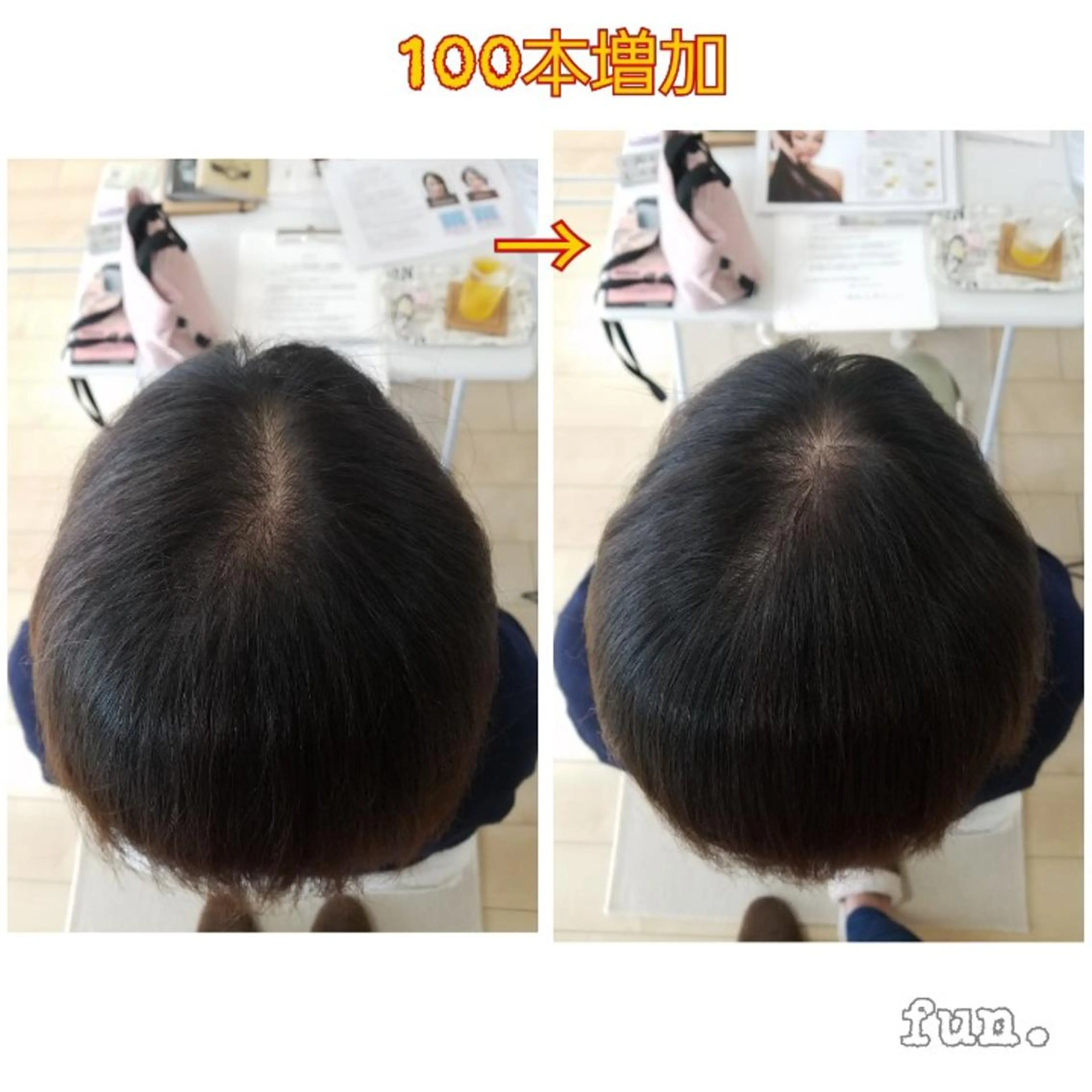 ショート エクステ fun./ヘアセット /エクステ/着付のその他イメージ