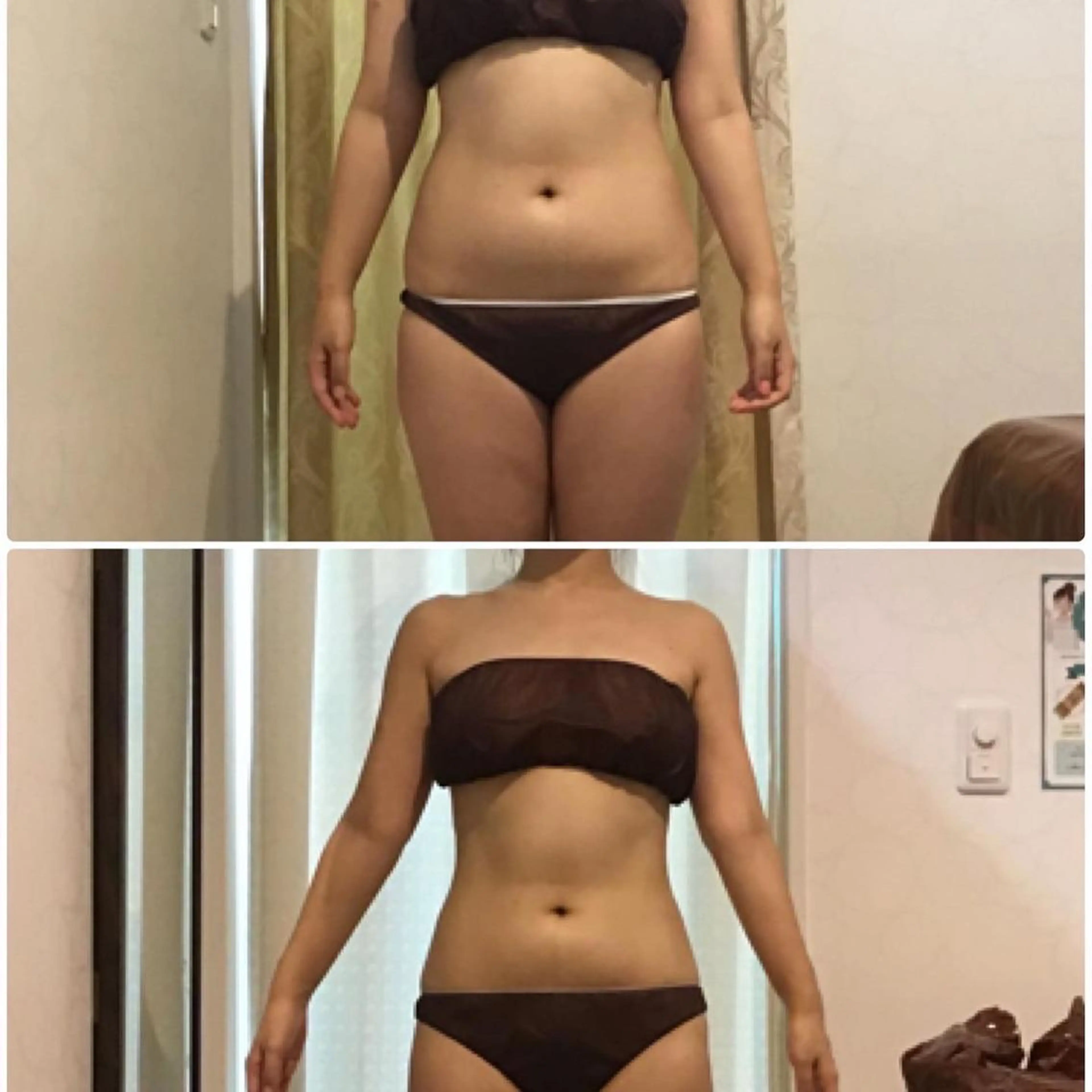 次世代ハイ　フォーカスボディ＋期間限定ラジオ波付き　美Bodyへの写真