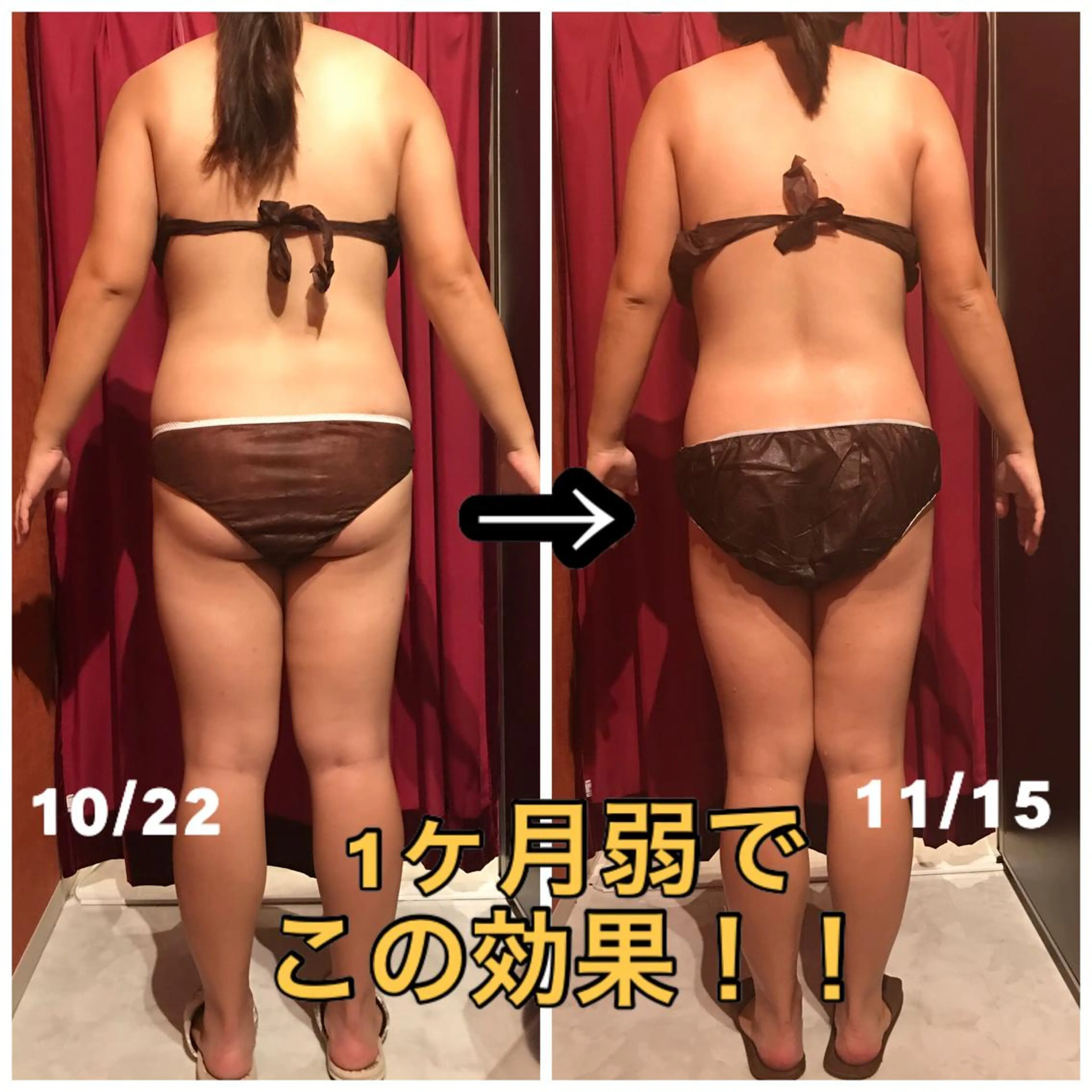 Cielo(シエロ) ダイエット専門店のエステ・リラクイメージ