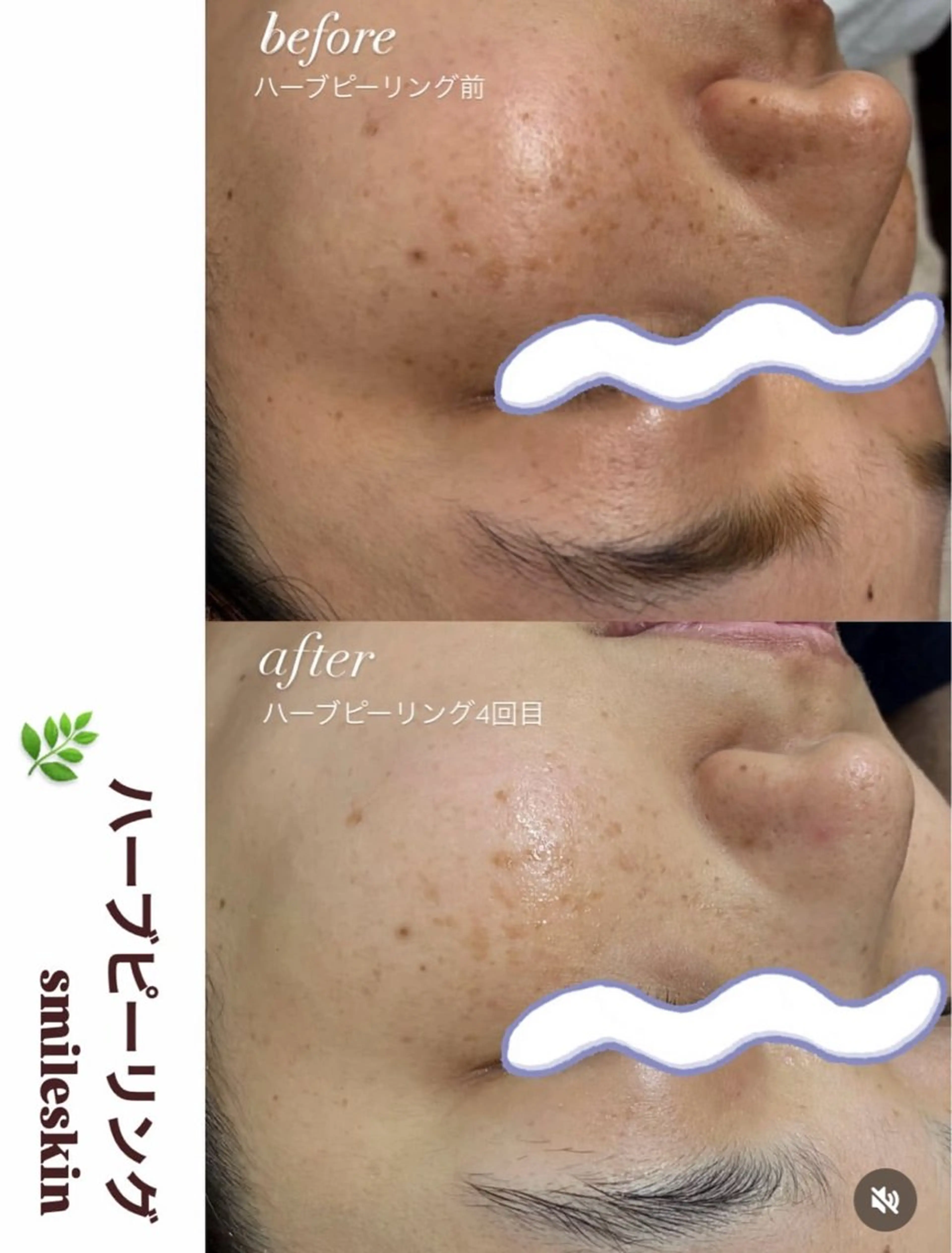 エステ smile nail スマイルネイルのその他イメージ