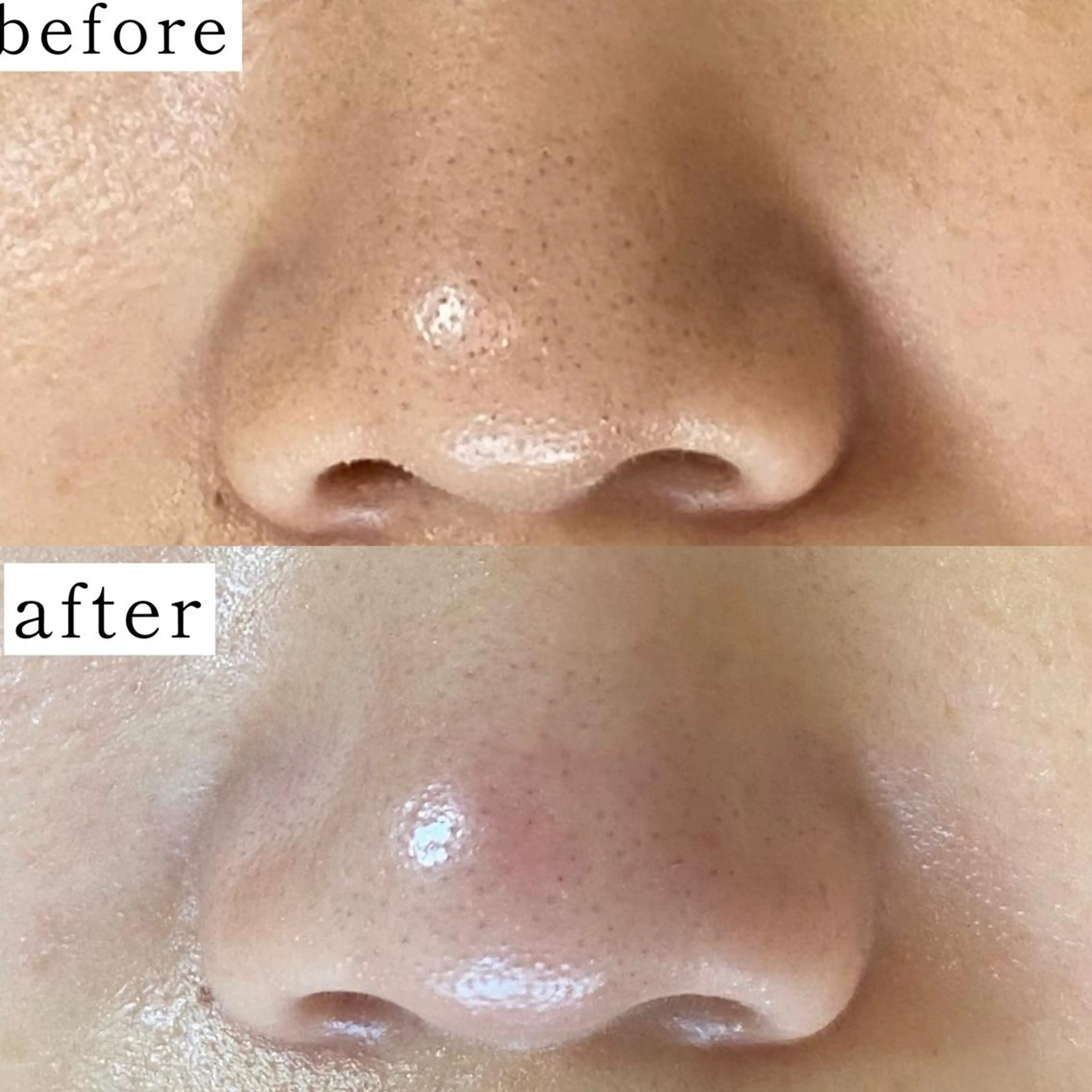 毛穴専門サロン　フルール所属・フルールFululu 自由が丘のエステ・リラクイメージ