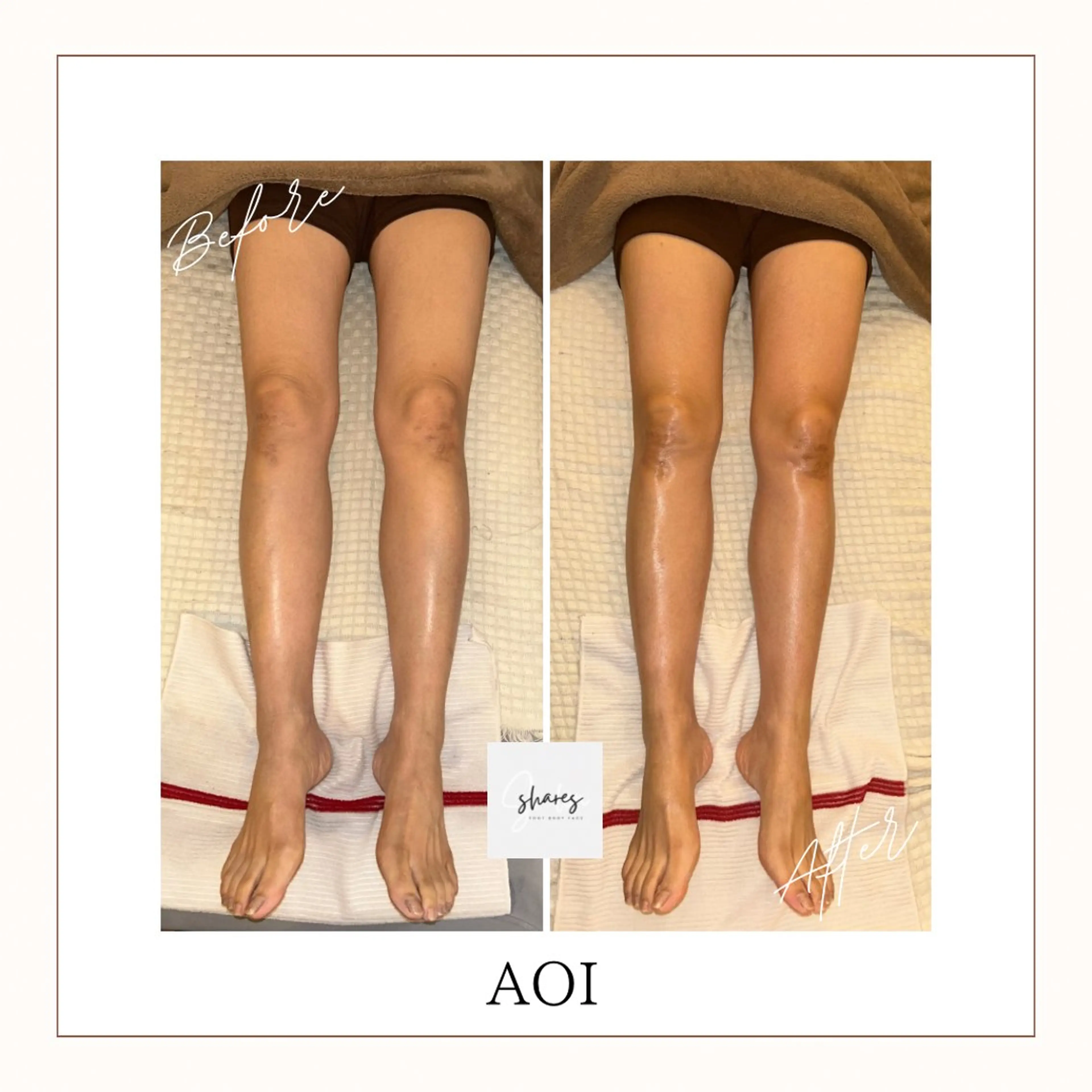 salon shares 辻堂店所属・SHARES AOIのエステ・リラクイメージ