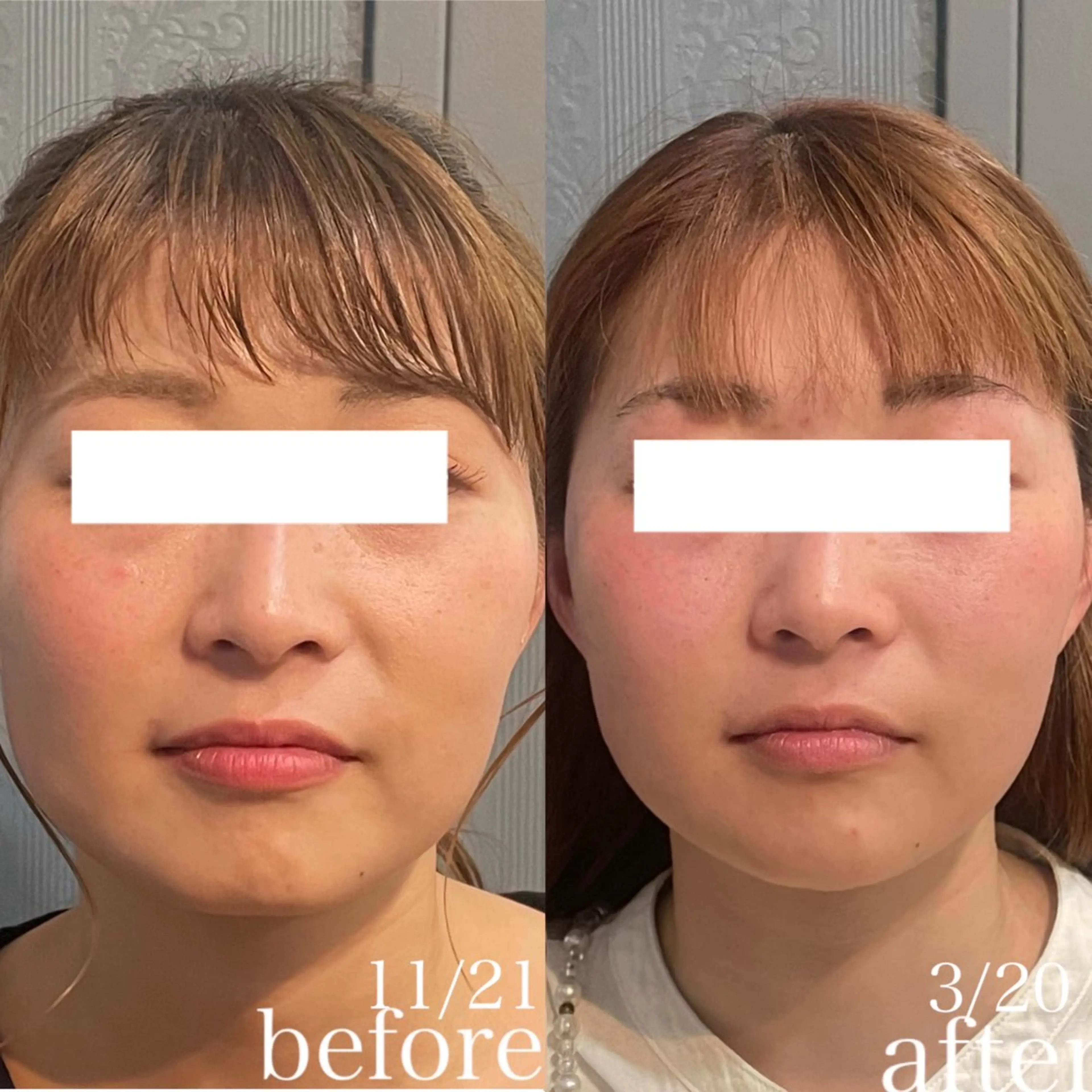 骨気&Relaxation vivian所属・VIVIAN 前田のエステ・リラクイメージ