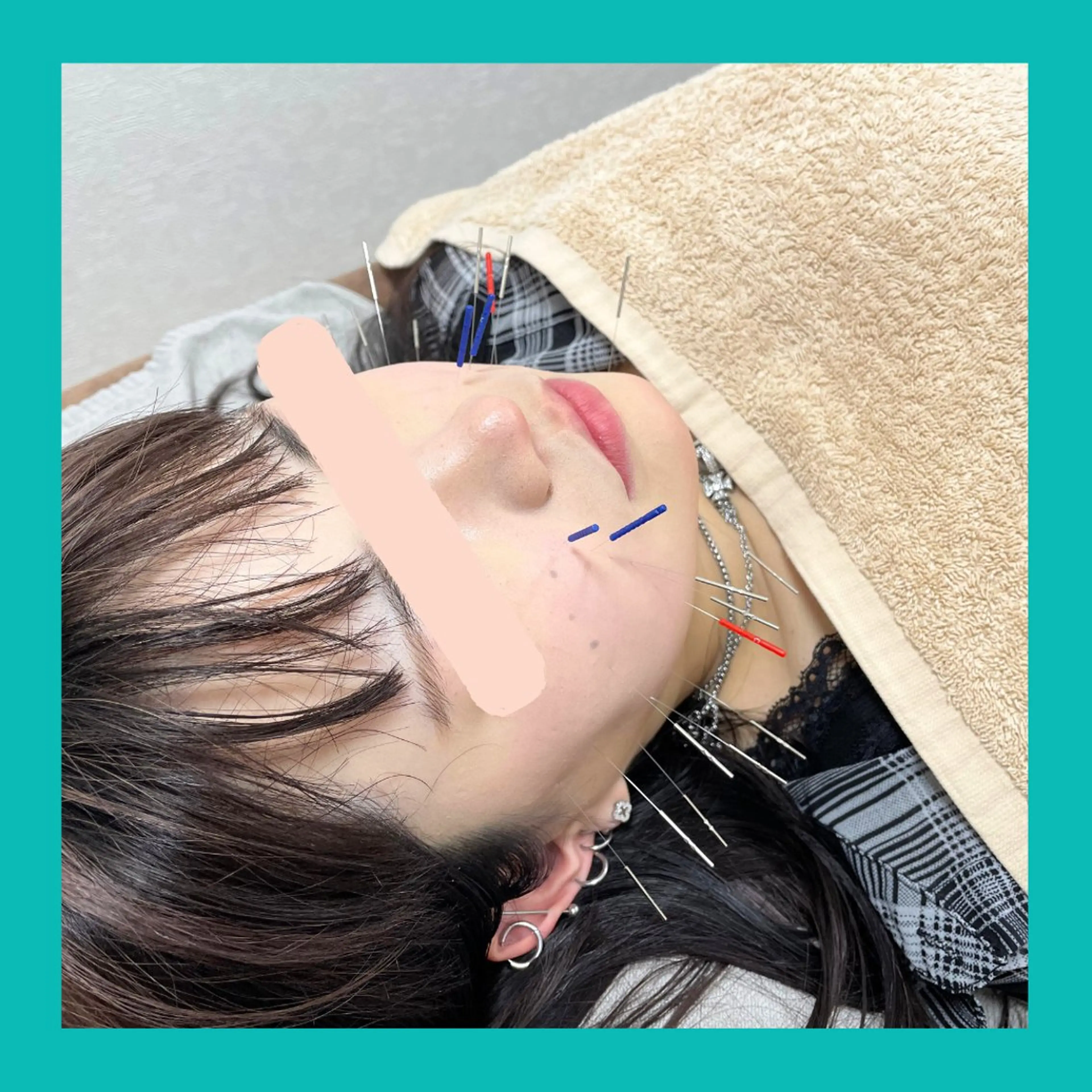 キャンディ鍼灸整骨院 きくたのその他イメージ