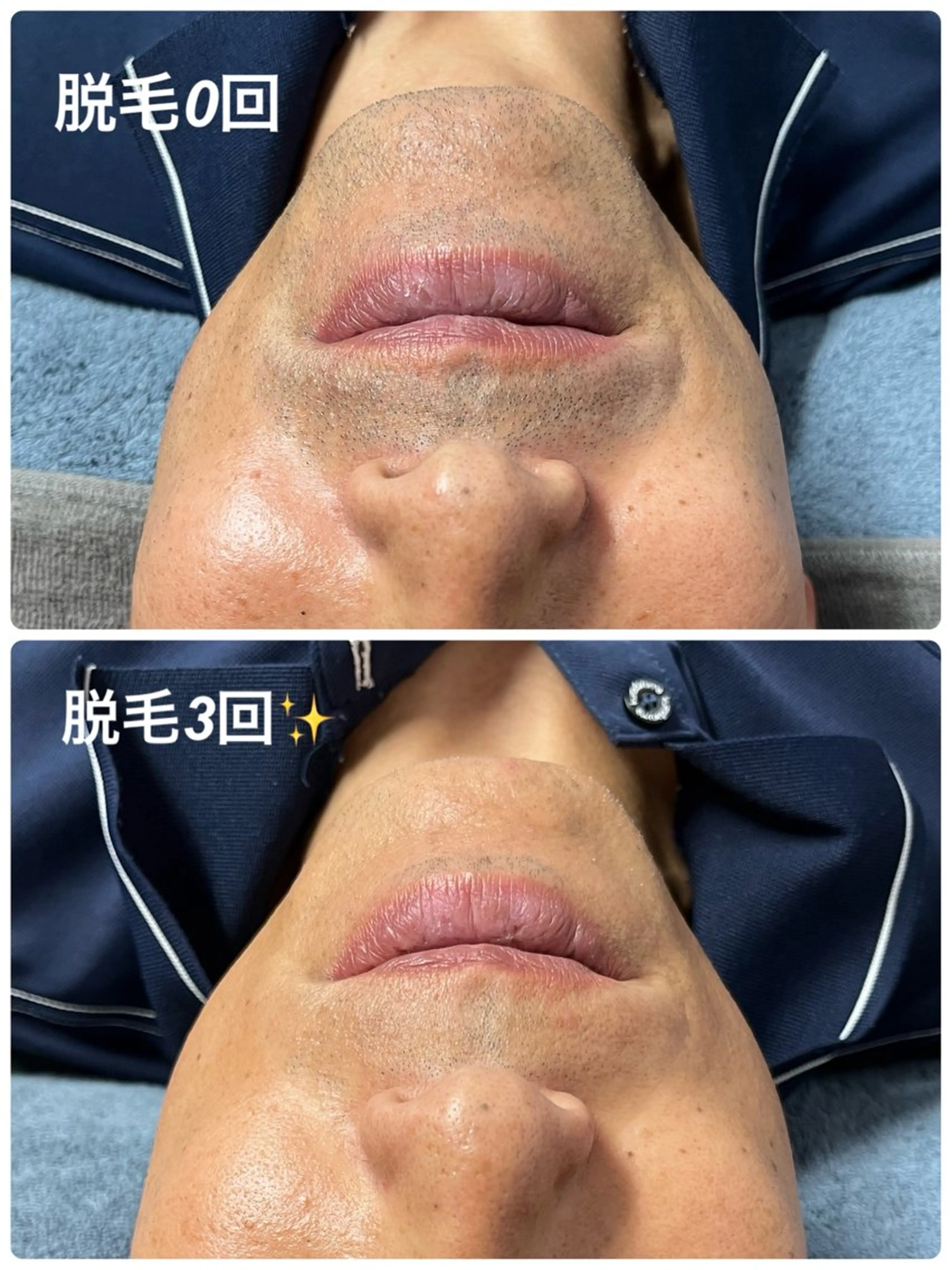 blue.【都度払い脱毛&フェイシャルサロン】所属・blue.💙【 脱毛&フェイシャル】のエステ・リラクイメージ