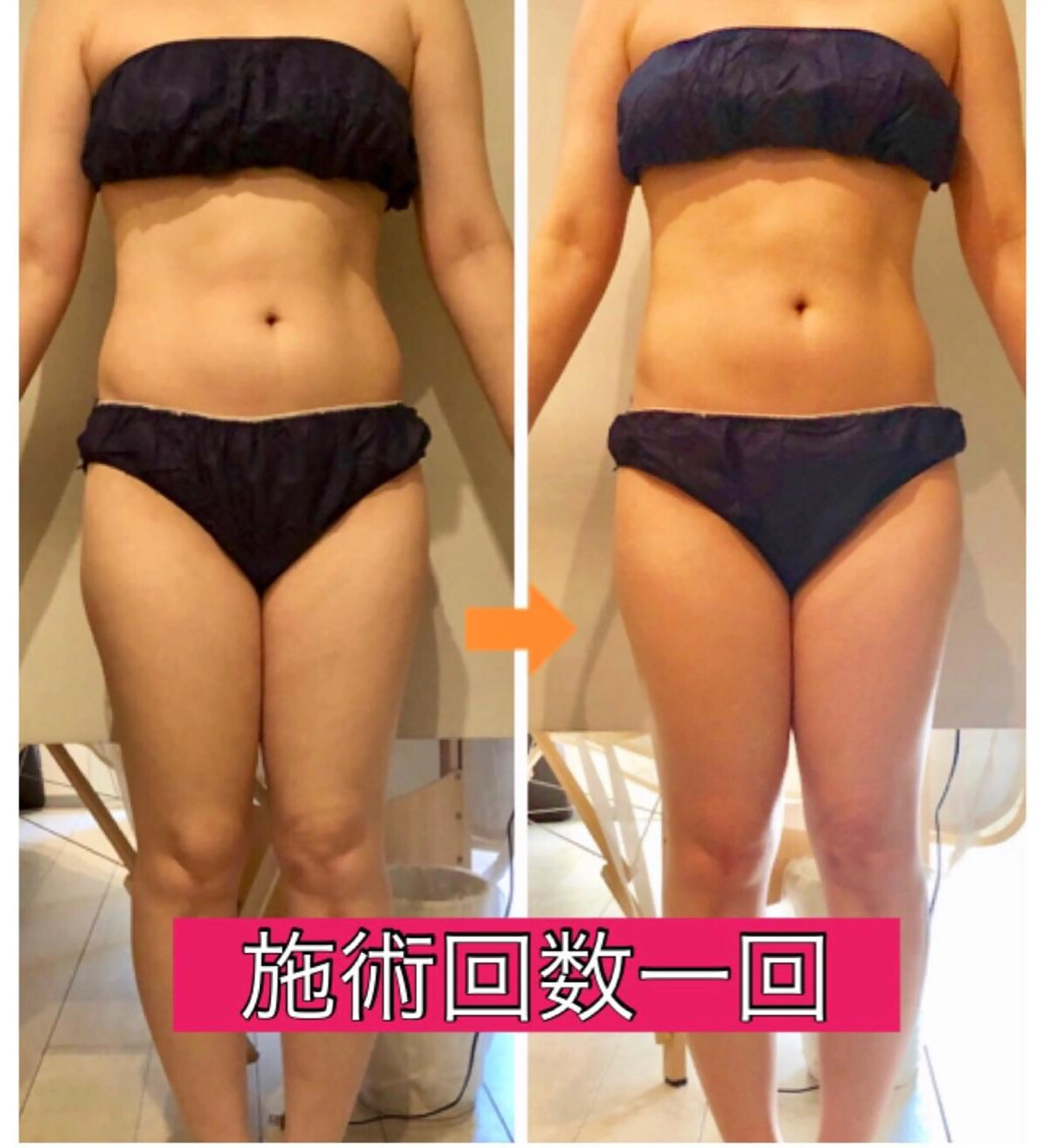 ロング カラー パーマ ヘアアレンジ メンズ キッズ ネイル マツエク・マツパ ‍痩身＆ボディ 結果出し🌟丹野のエステ・リラクイメージ