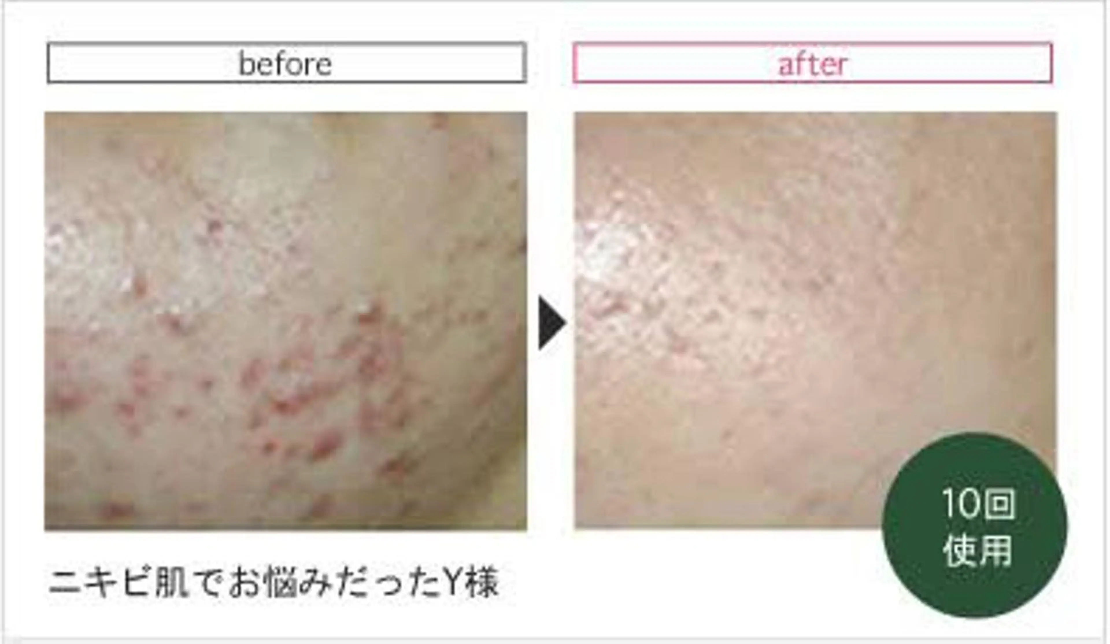 ハーブピーリング専門 muro.のエステ・リラクイメージ