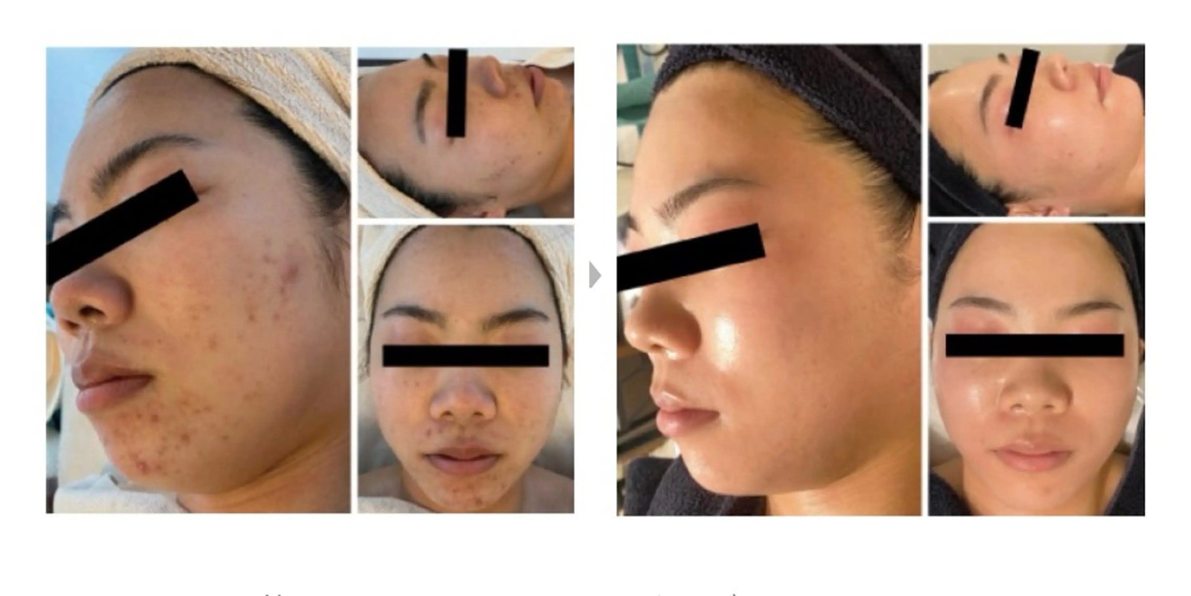 Serapia 【セラピア】のマツエク・マツパデザイン