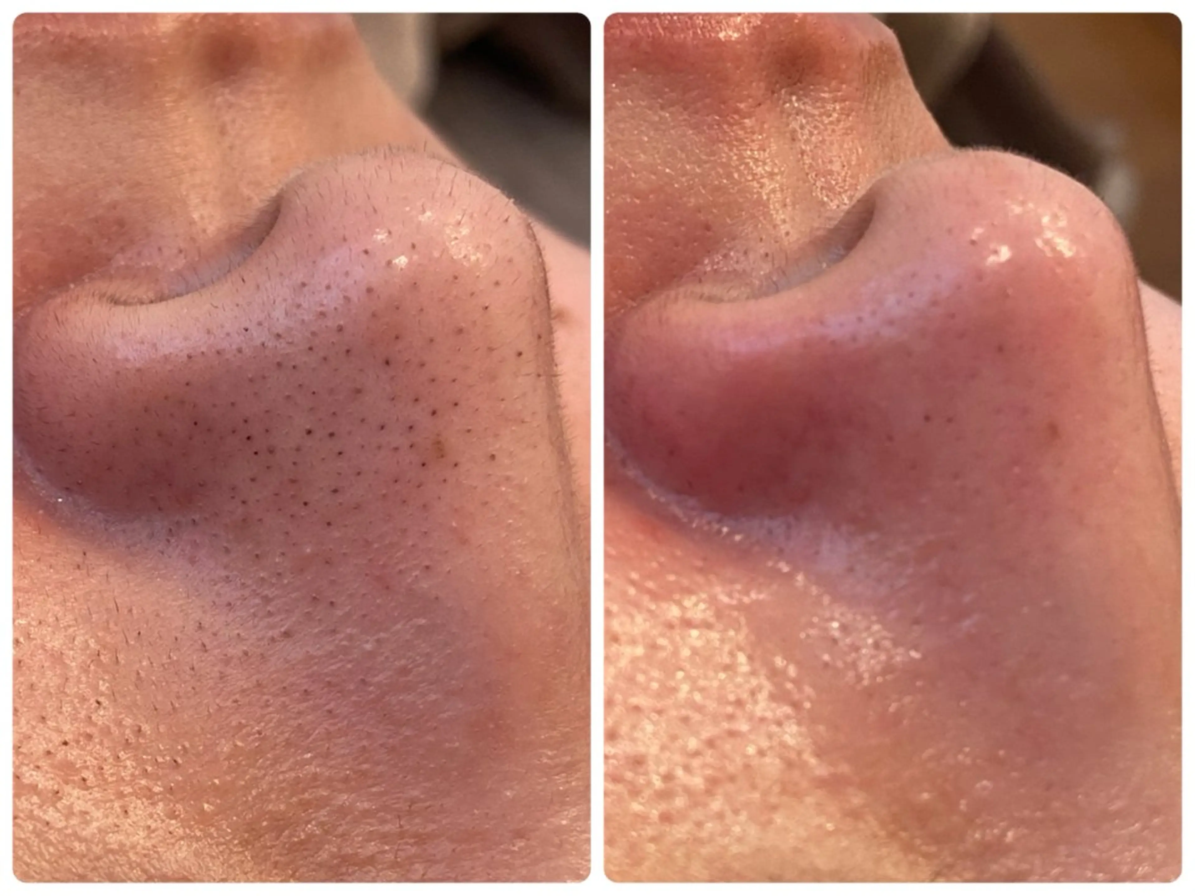 Hisui 小出のエステ・リラクイメージ