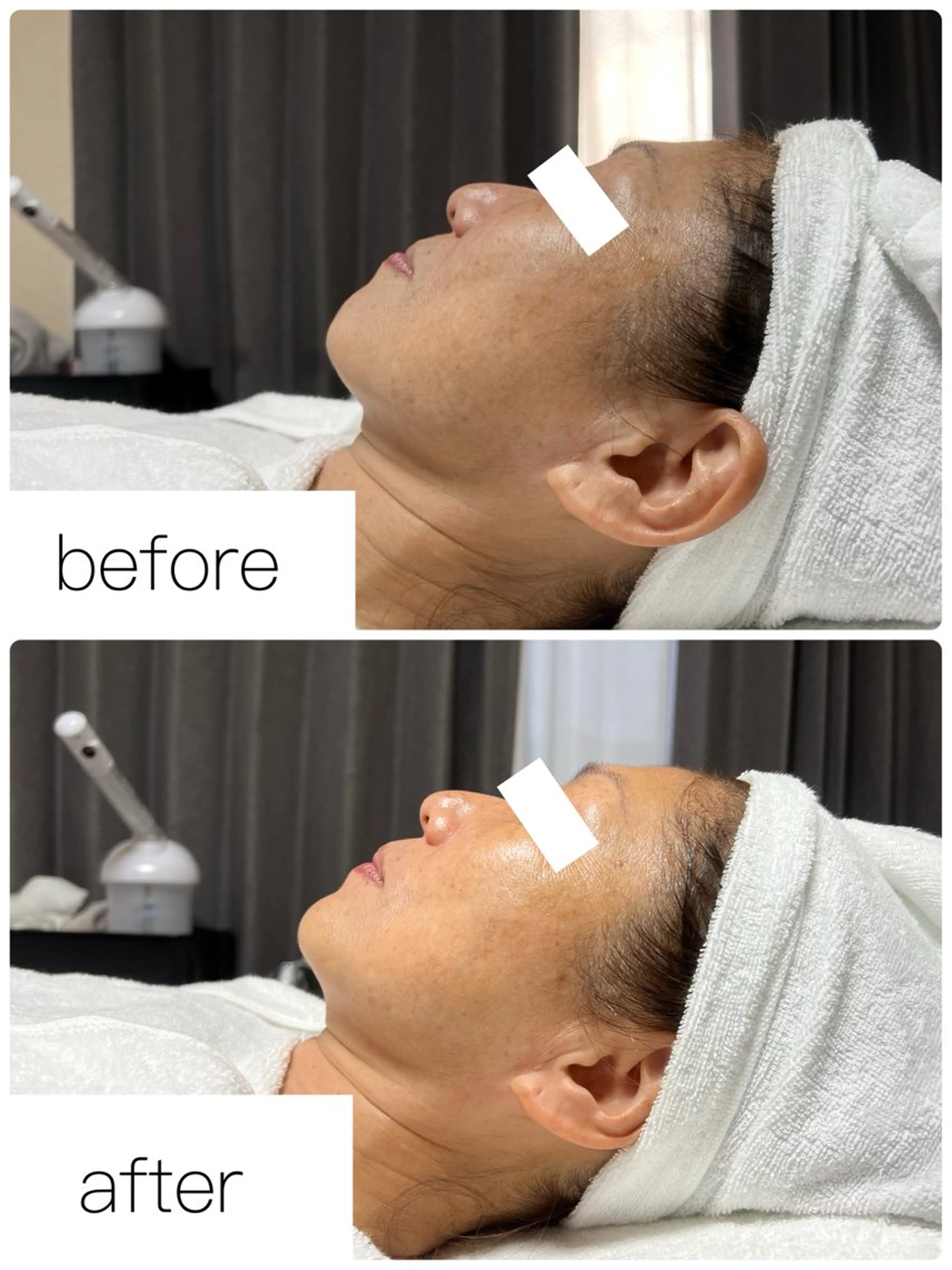 エステ ROR Akariのエステ・リラクイメージ