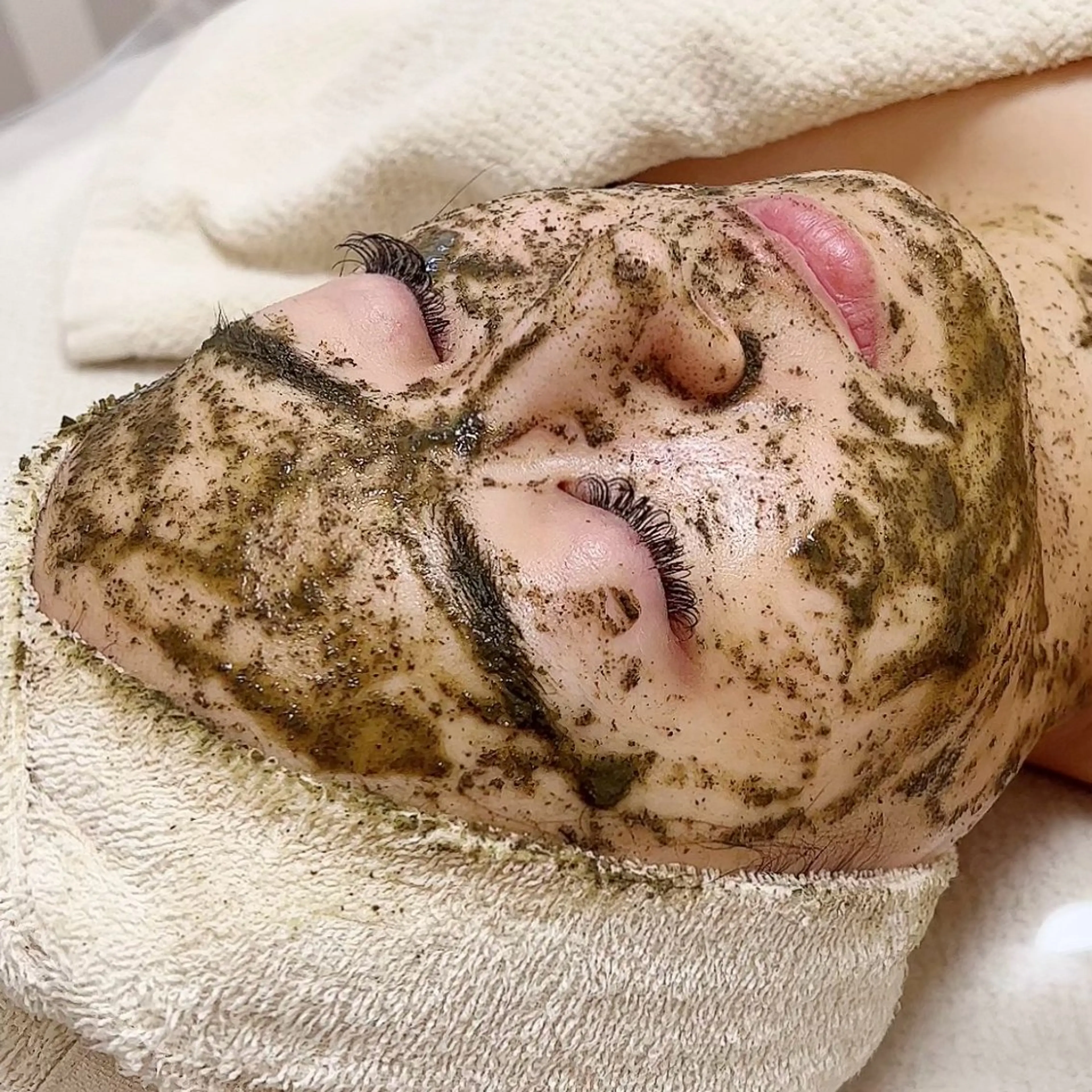 【初めての方にオススメ】幹細胞たっぷり剥けないハーブピーリング初体験🌿の写真