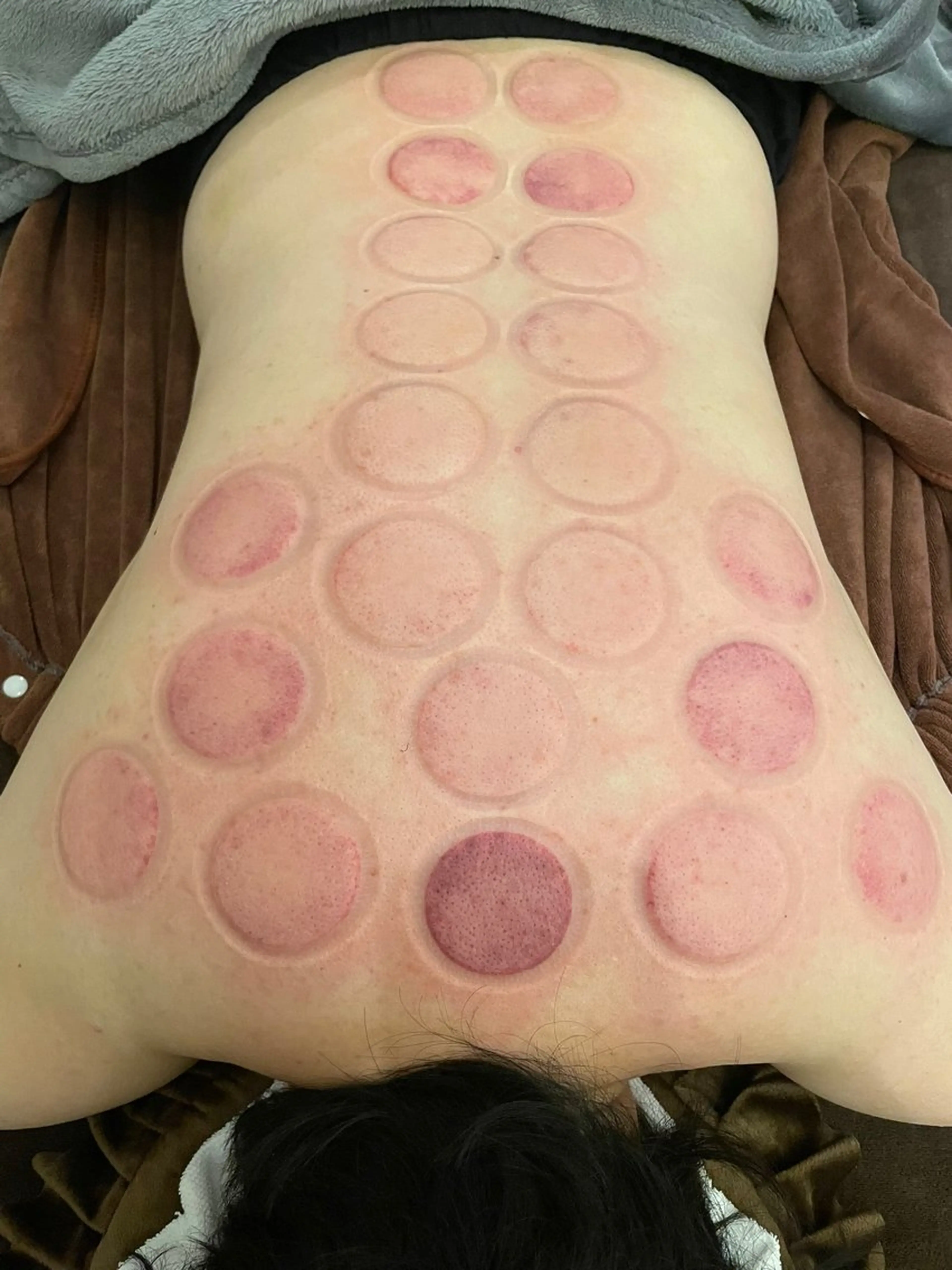 美容鍼/鍼灸 ここみ鍼灸院のエステ・リラクイメージ