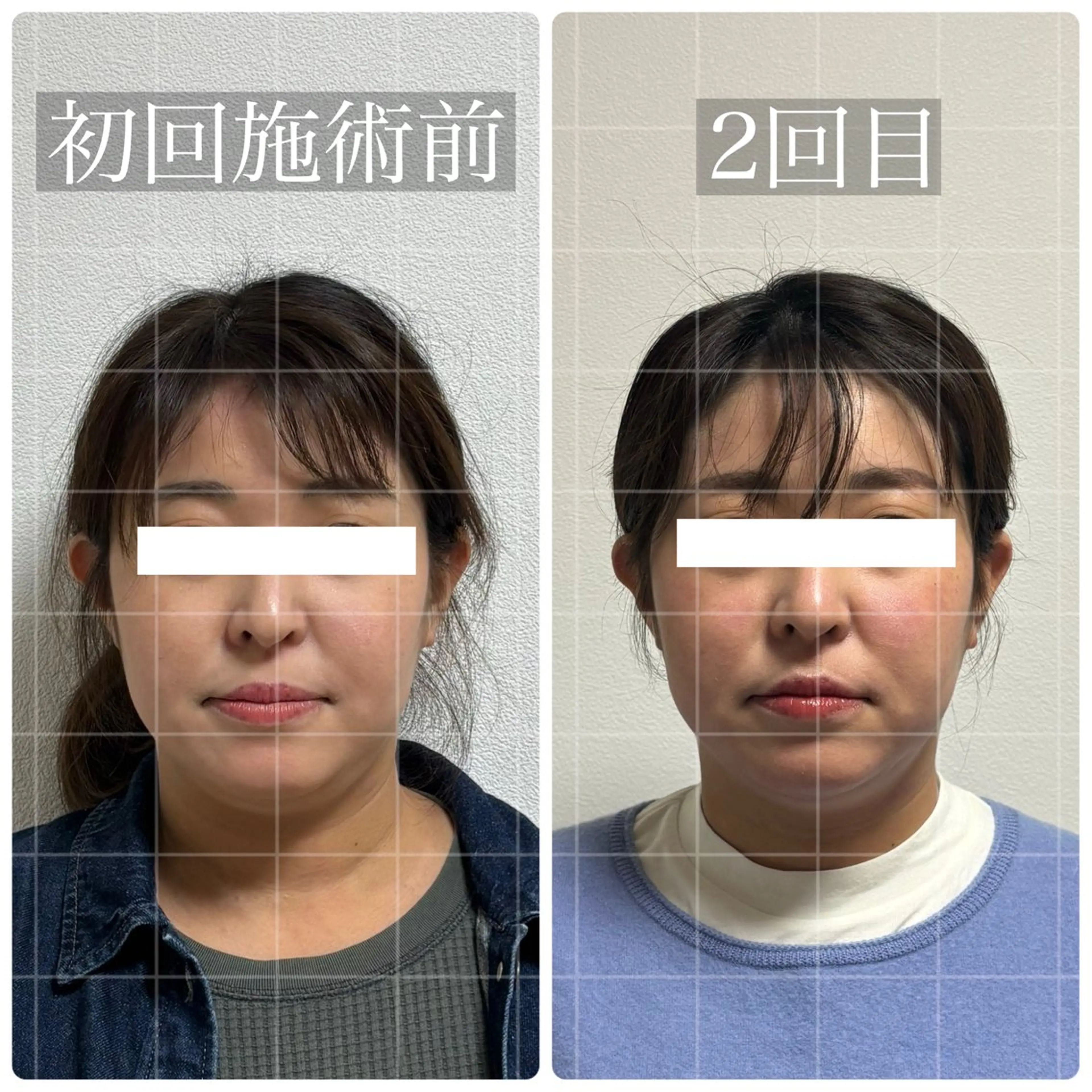 くつろぎ小顔サロン Lu mellow所属・片山けいこ｜ 美人顔創りの専門家のエステ・リラクイメージ